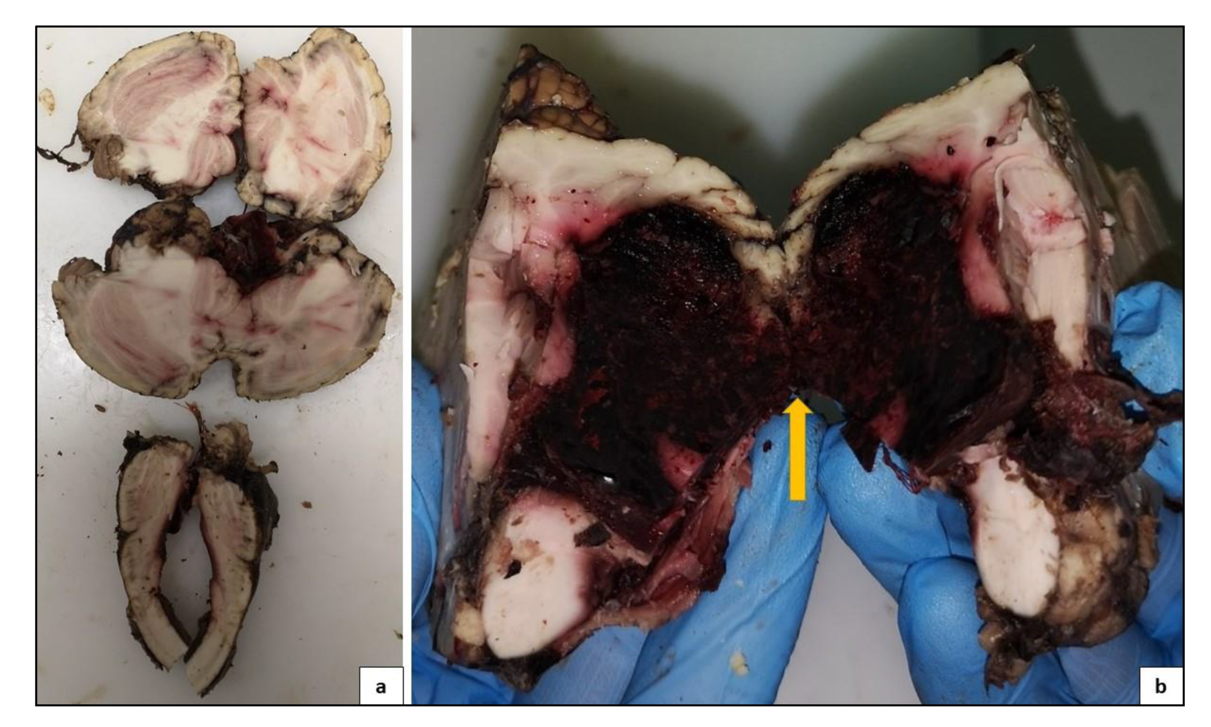 Medicina 57 00644 g005