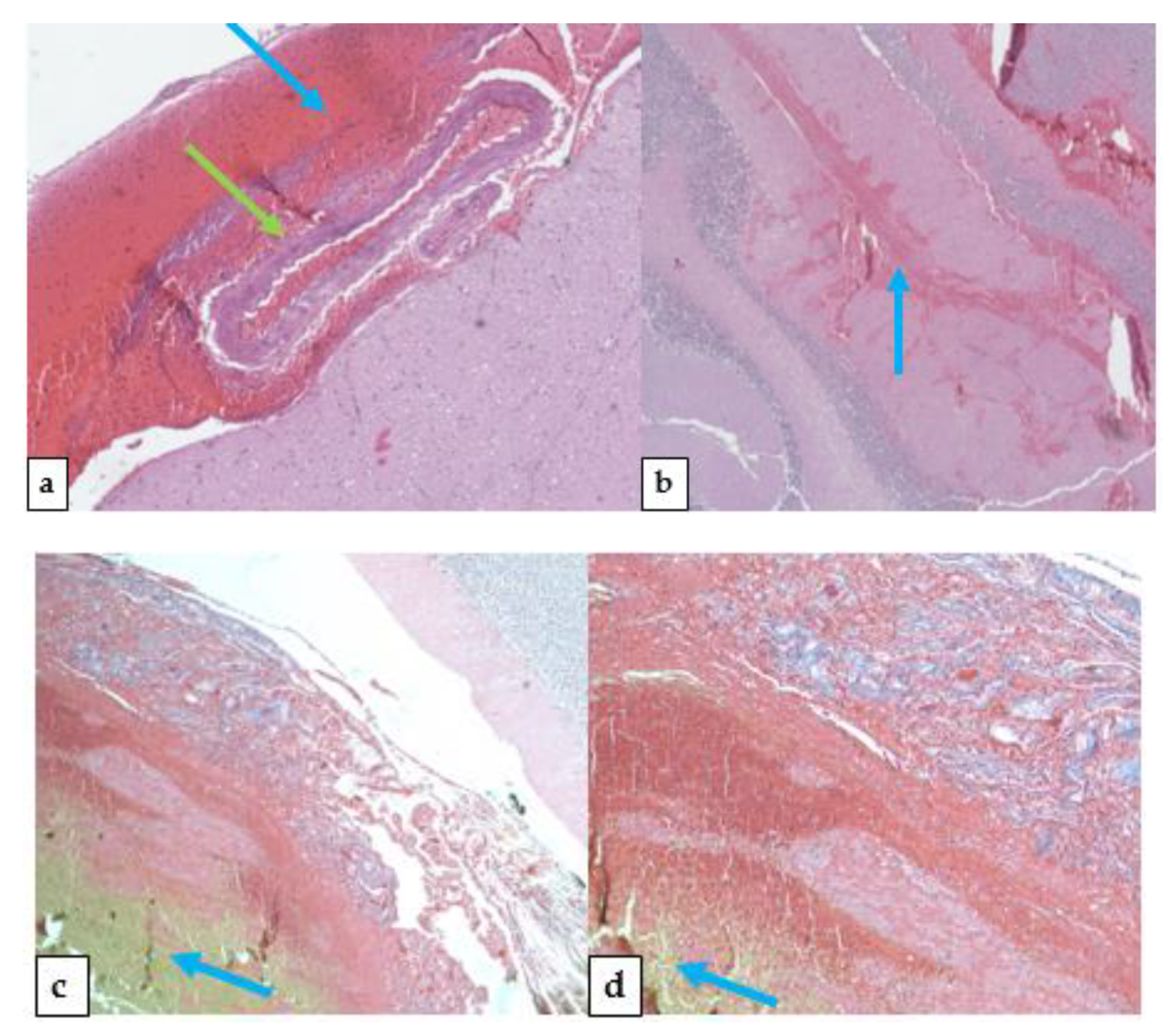 Medicina 57 00644 g006