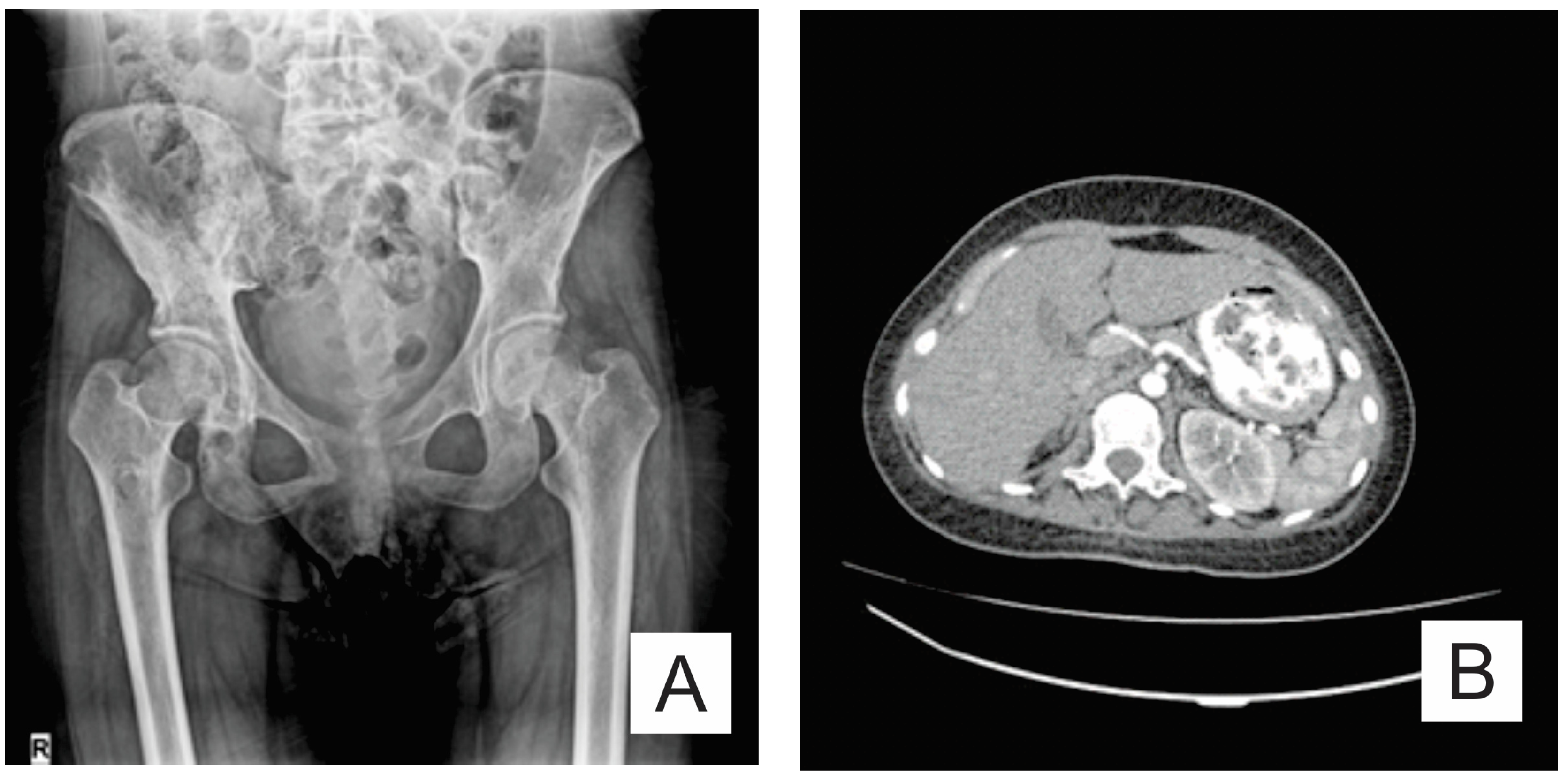 Medicina 57 00681 g004