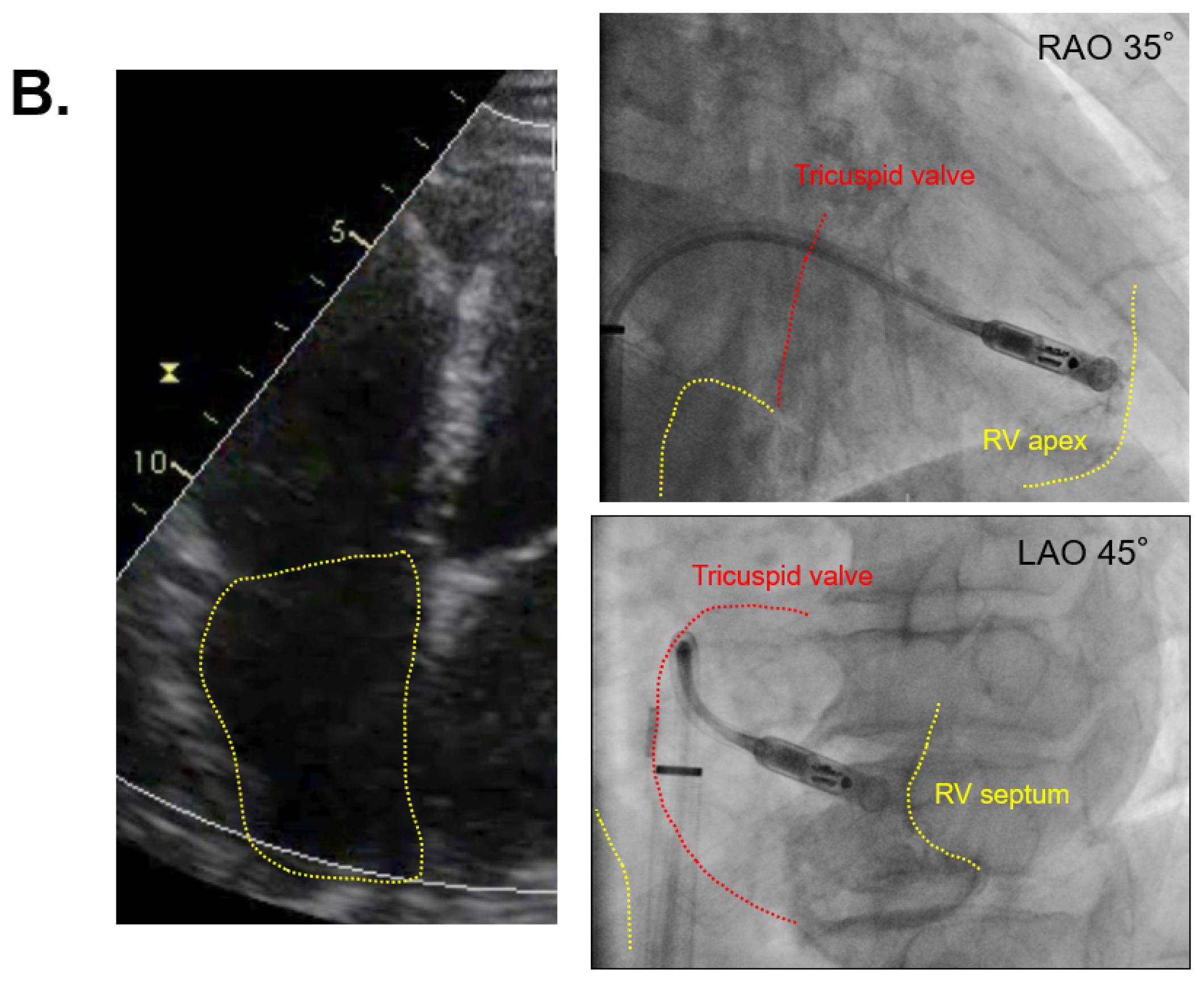 Medicina 57 00685 g003b