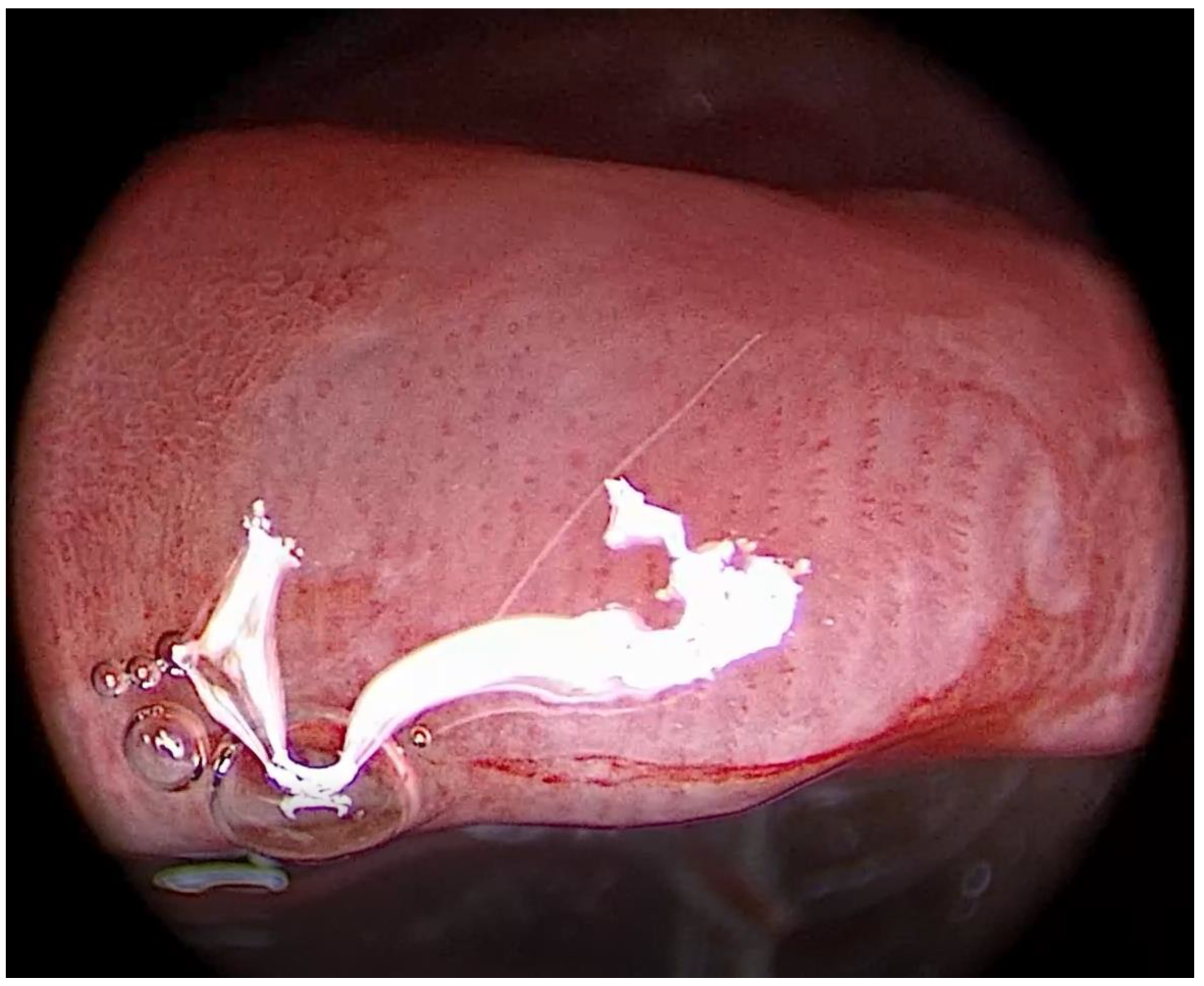 Medicina 57 00686 g002