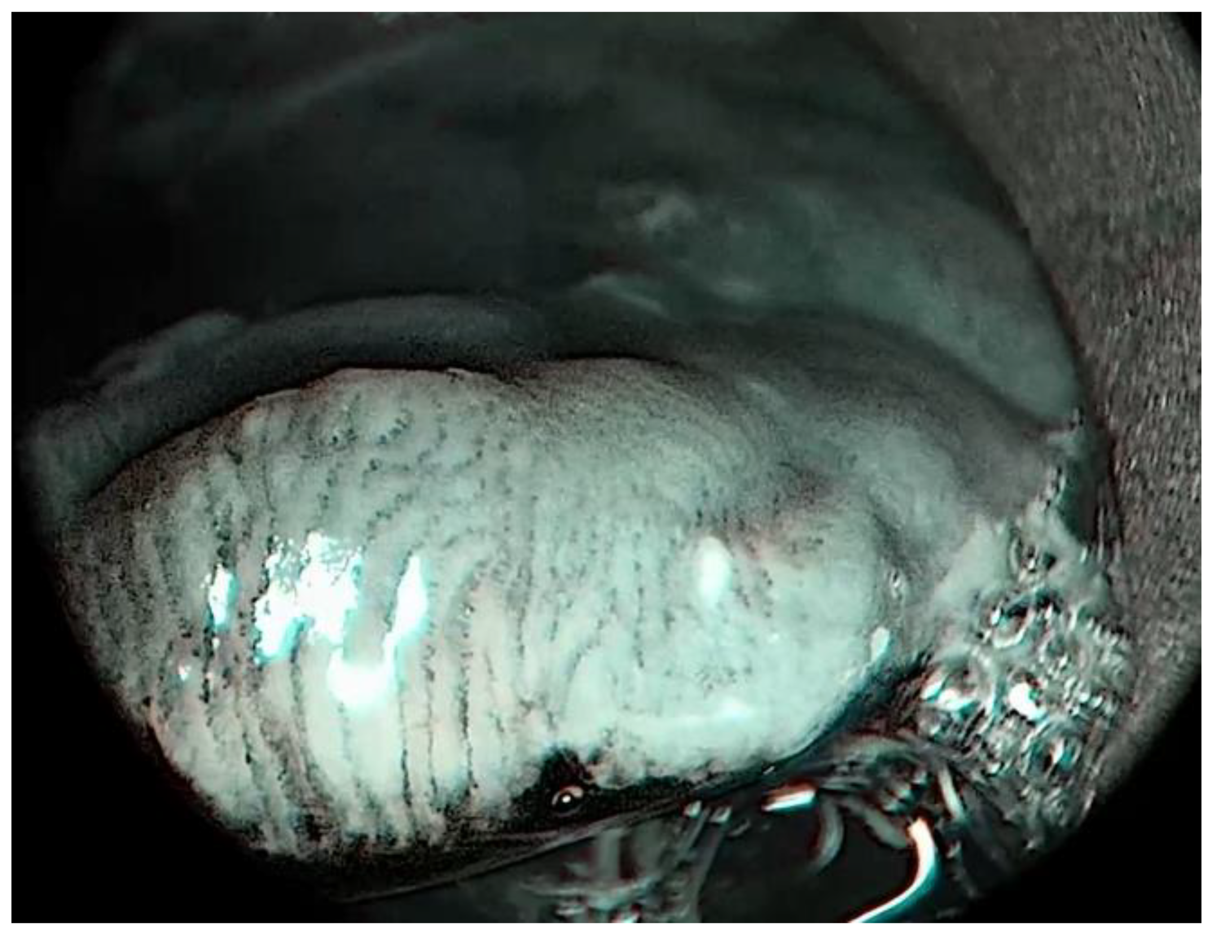 Medicina 57 00686 g003