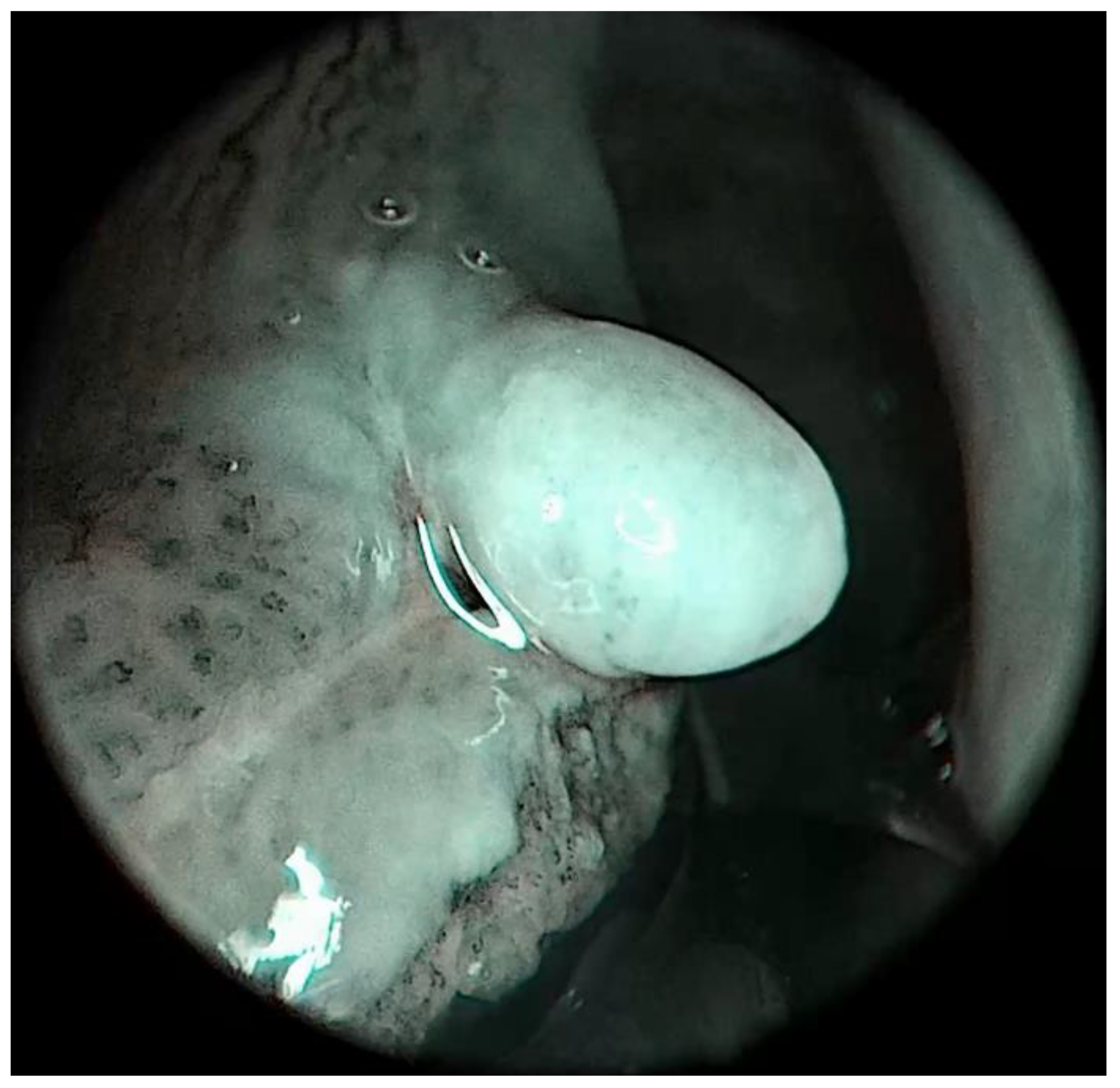 Medicina 57 00686 g004