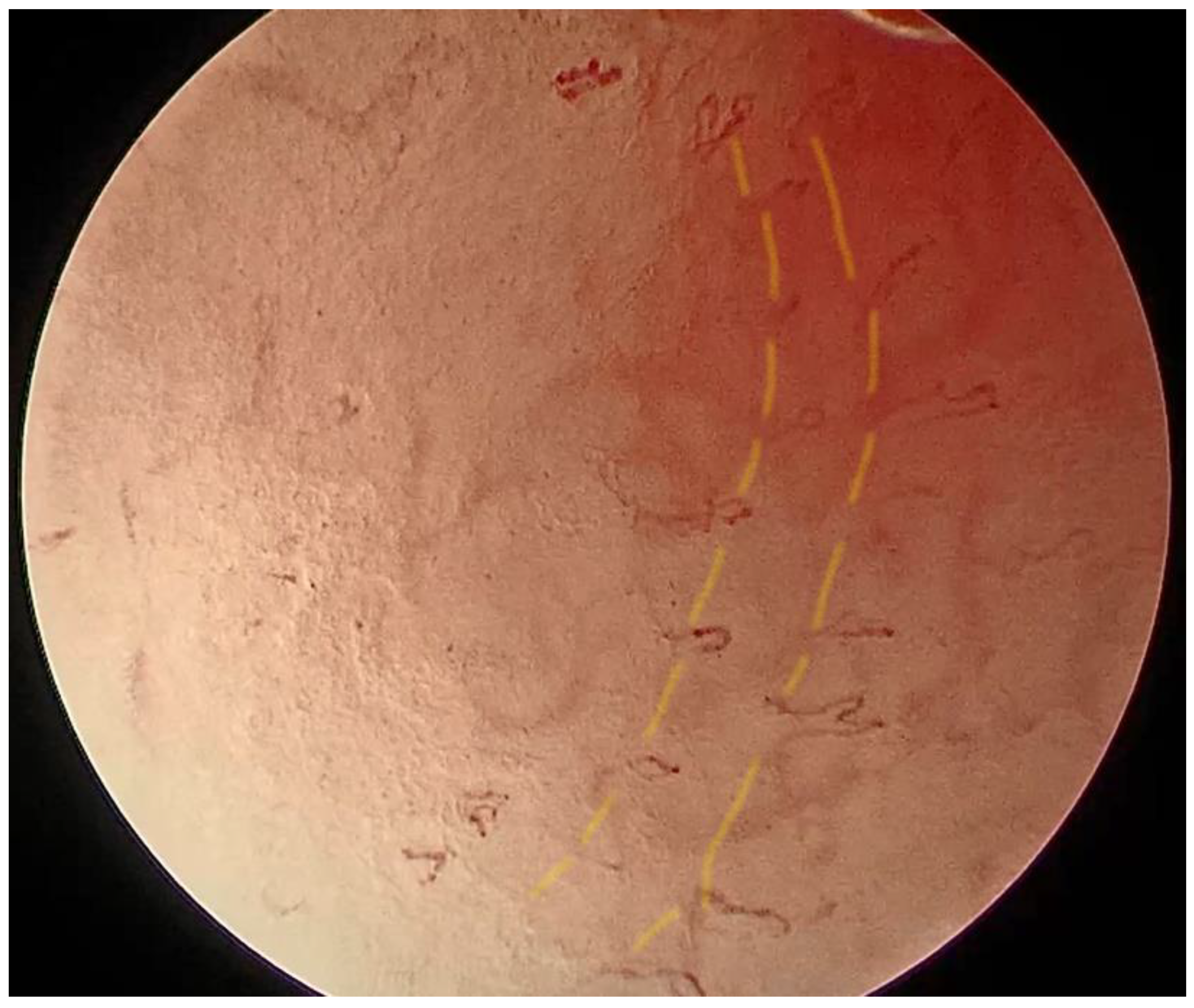 Medicina 57 00686 g005