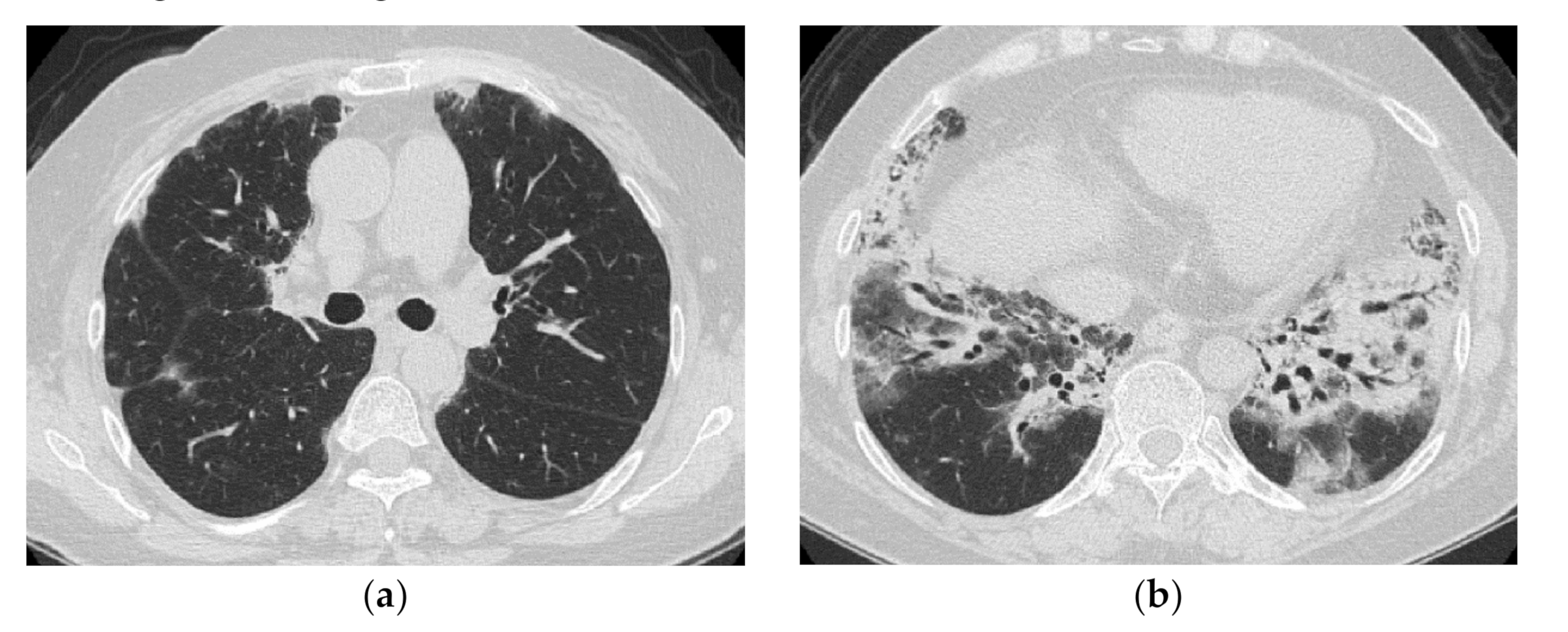 Medicina 57 00692 g004