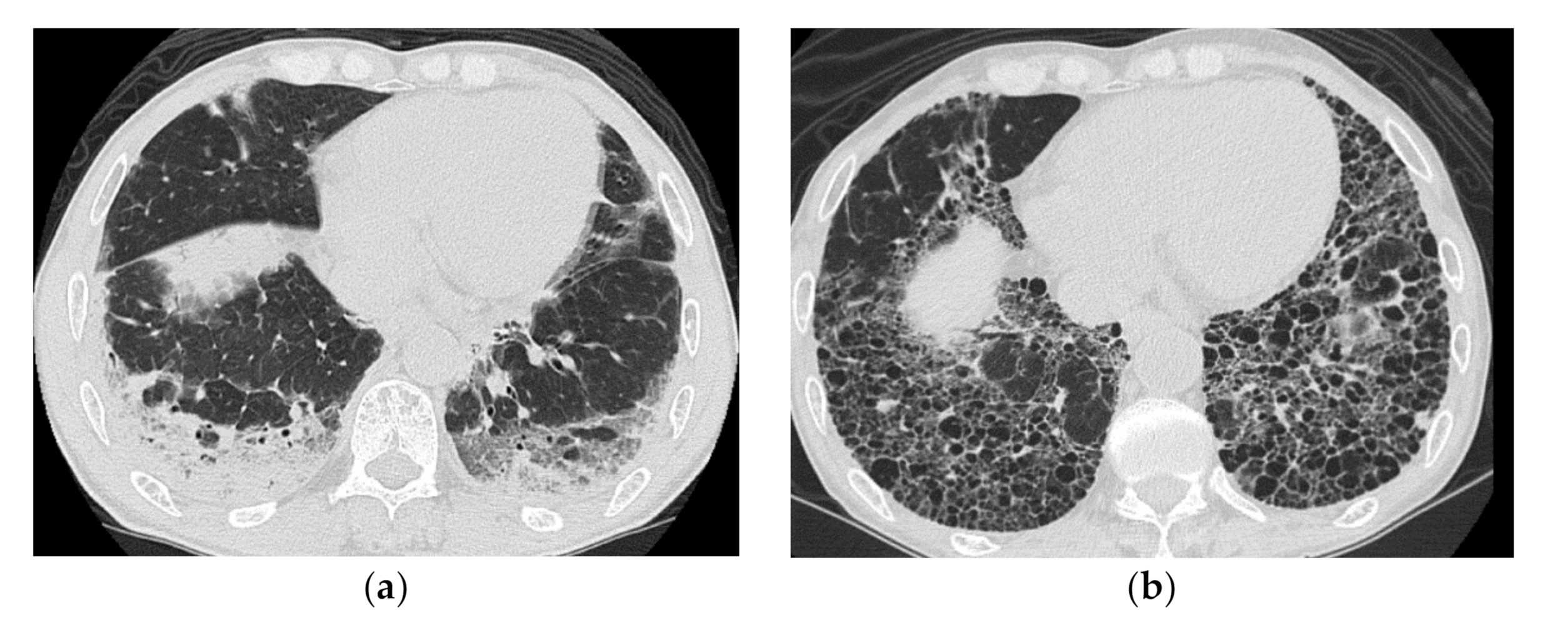 Medicina 57 00692 g005