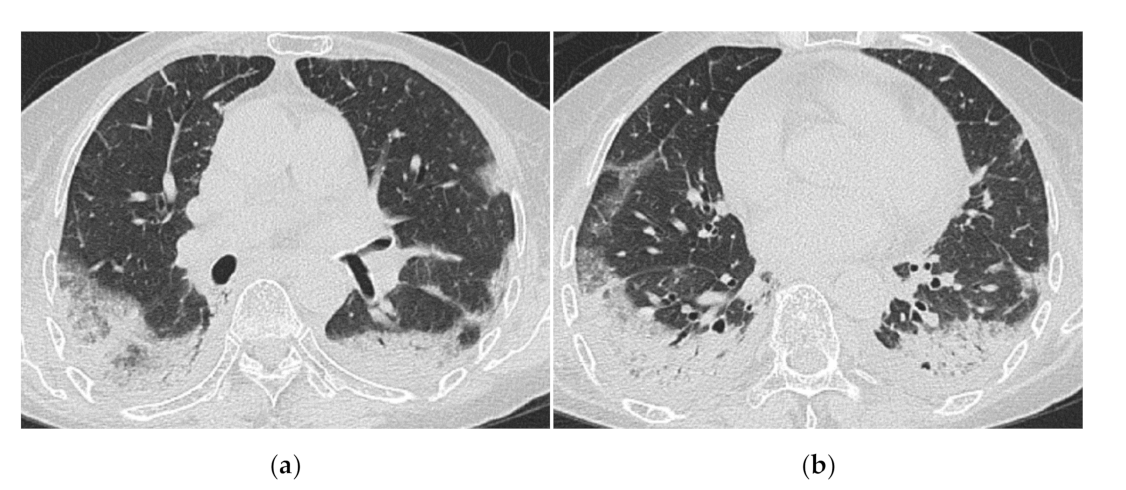 Medicina 57 00692 g007