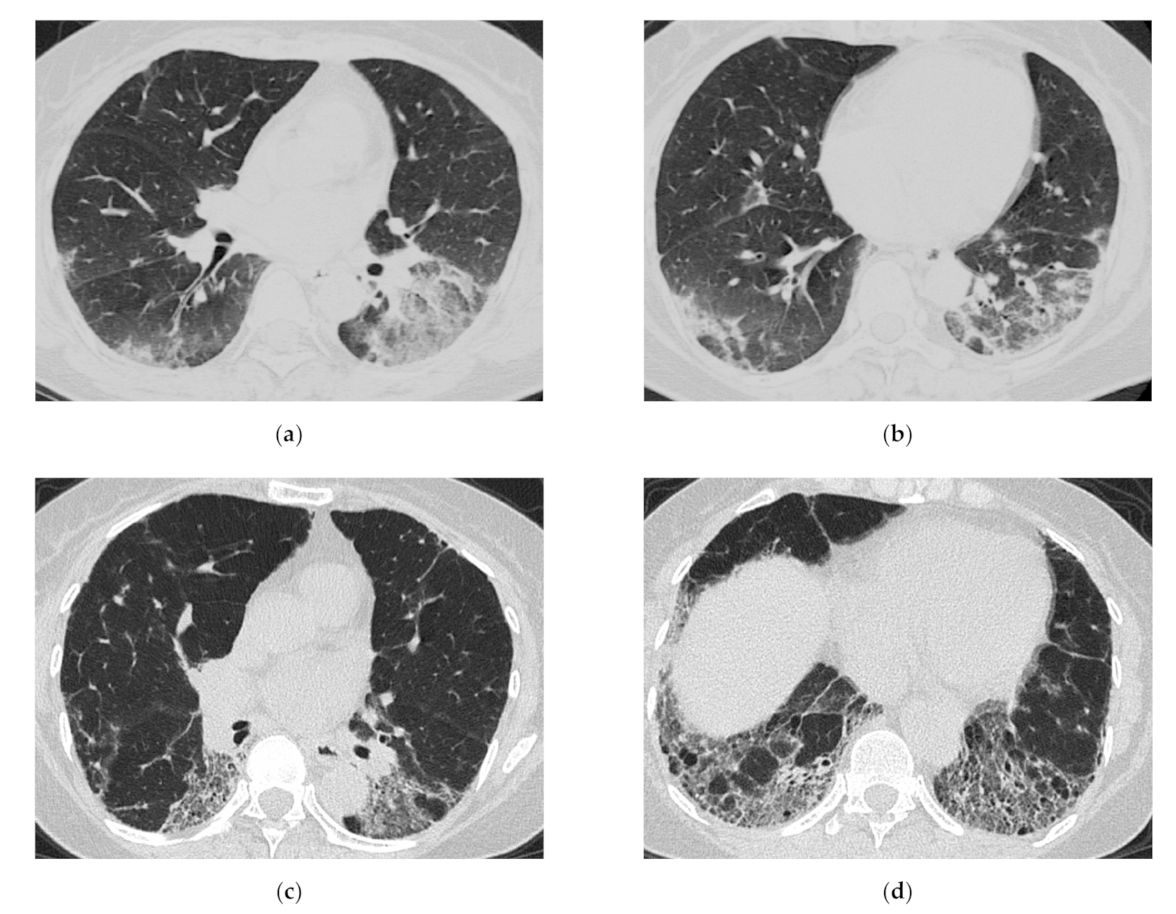 Medicina 57 00692 g008
