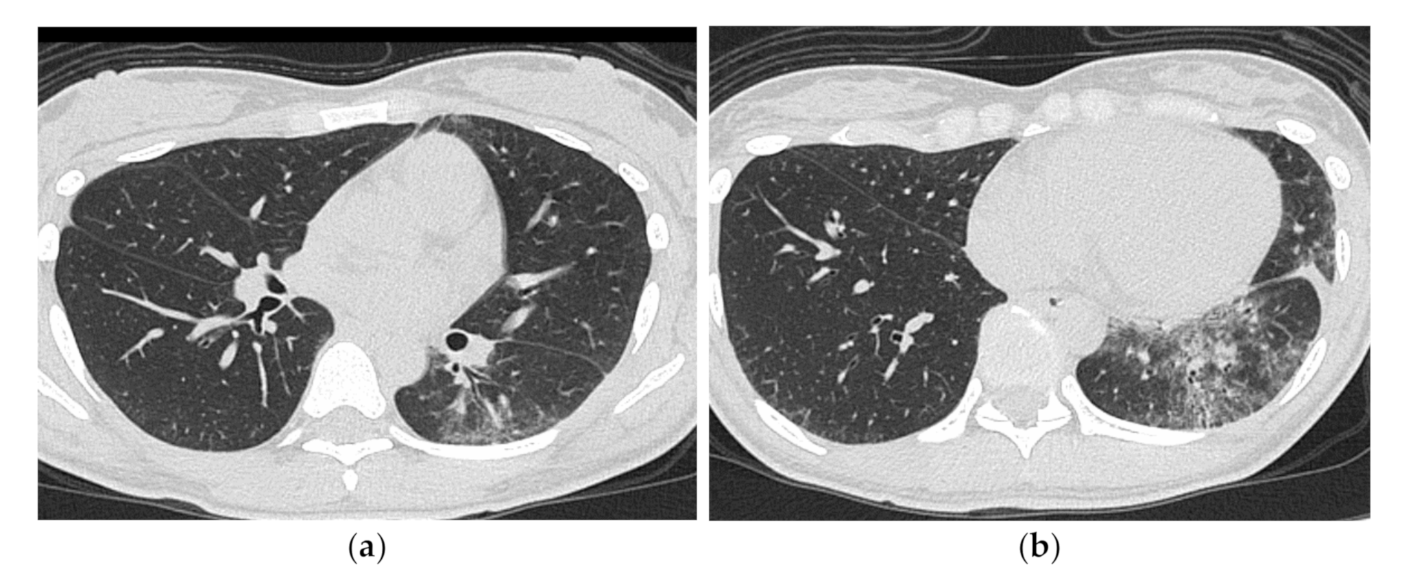 Medicina 57 00692 g009