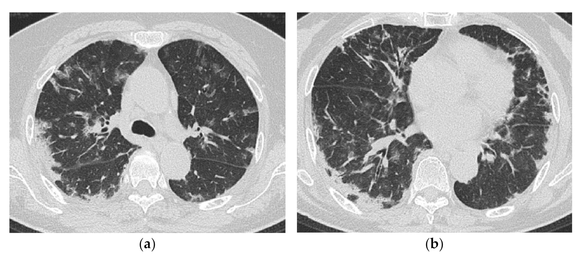 Medicina 57 00692 g012
