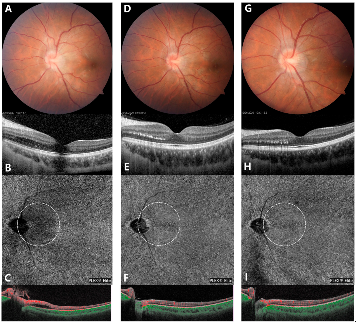 Medicina 57 00697 g002