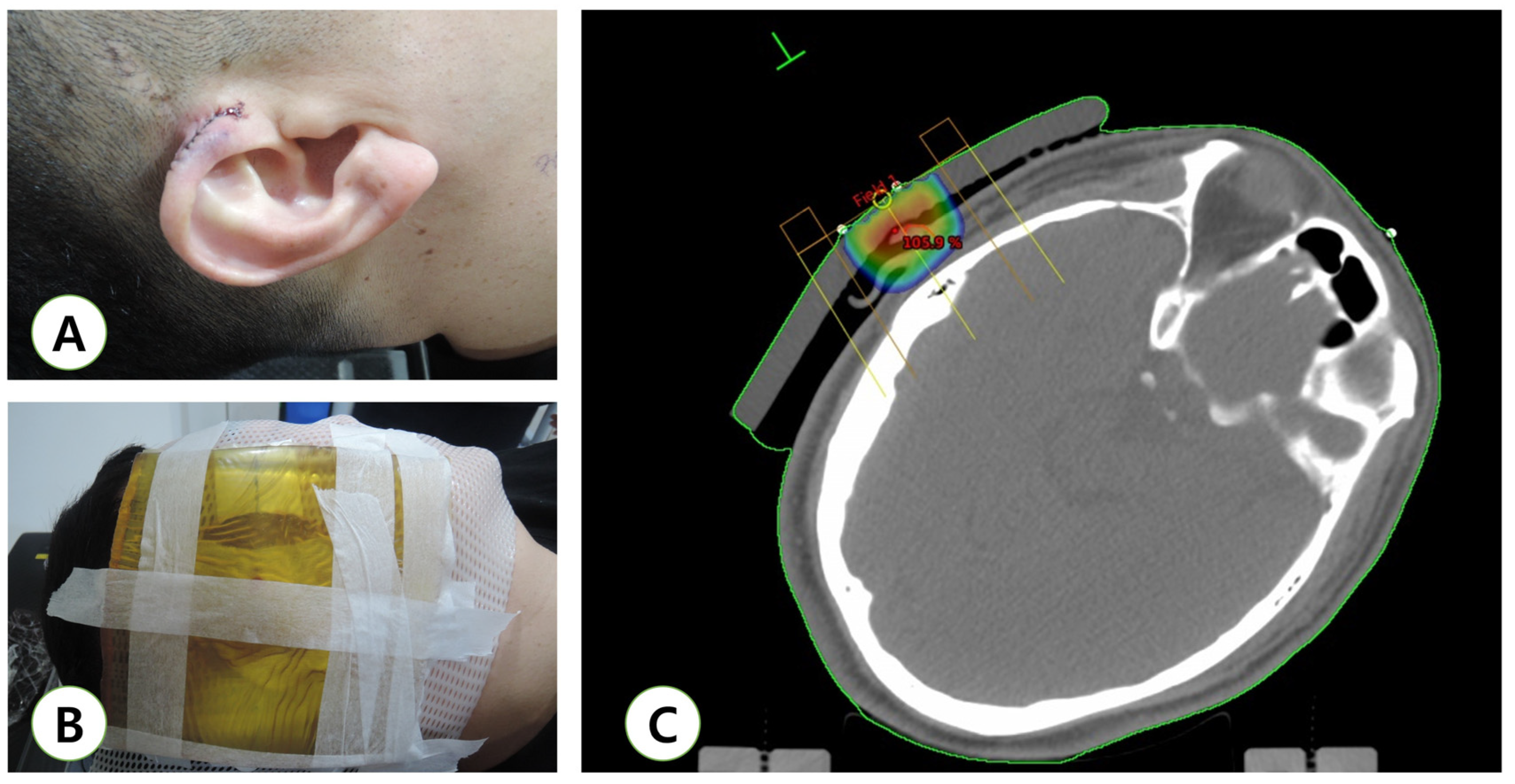 Medicina 57 00730 g001