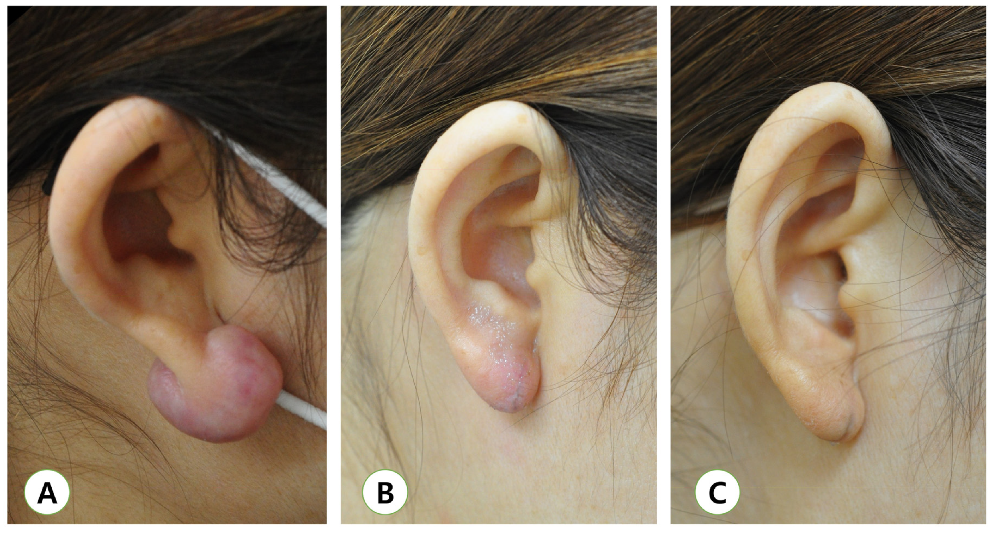 Medicina 57 00730 g003