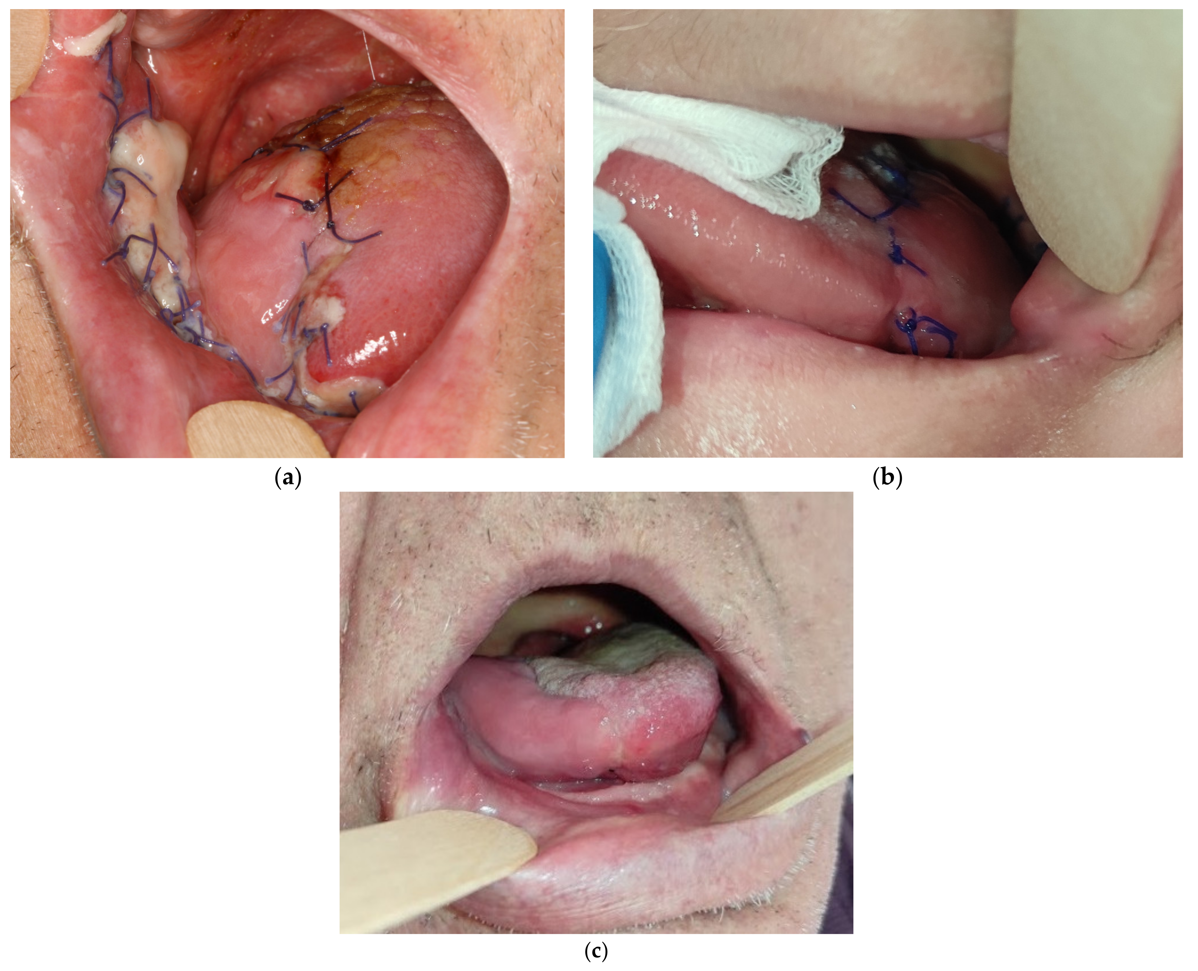 Medicina 57 00758 g005