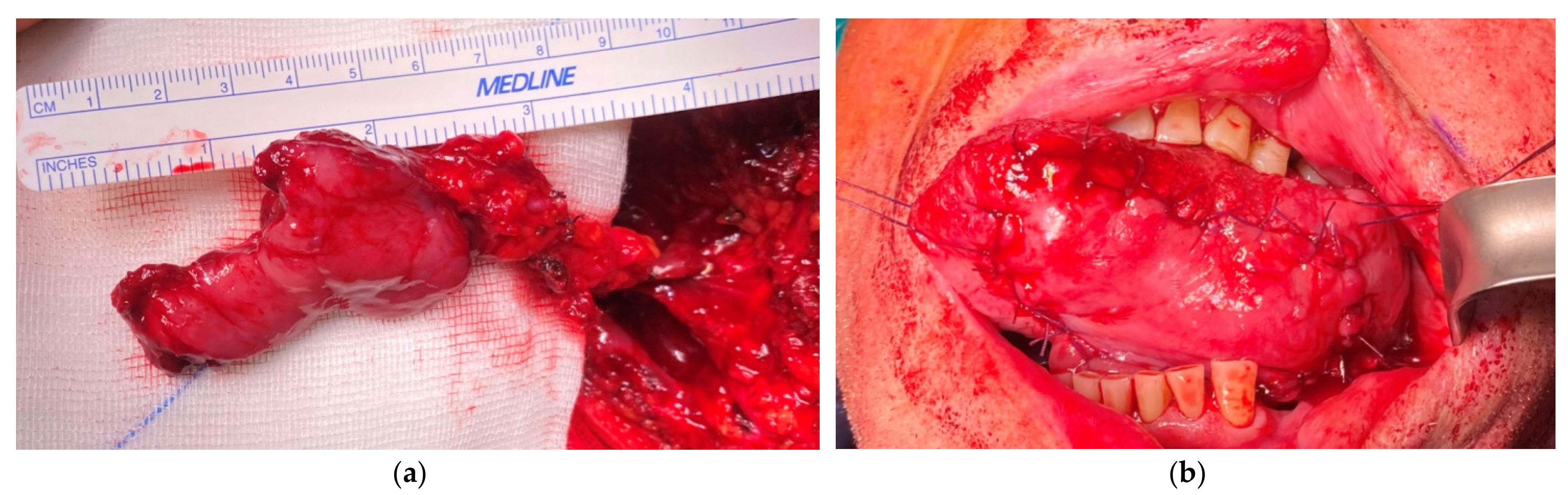 Medicina 57 00758 g006