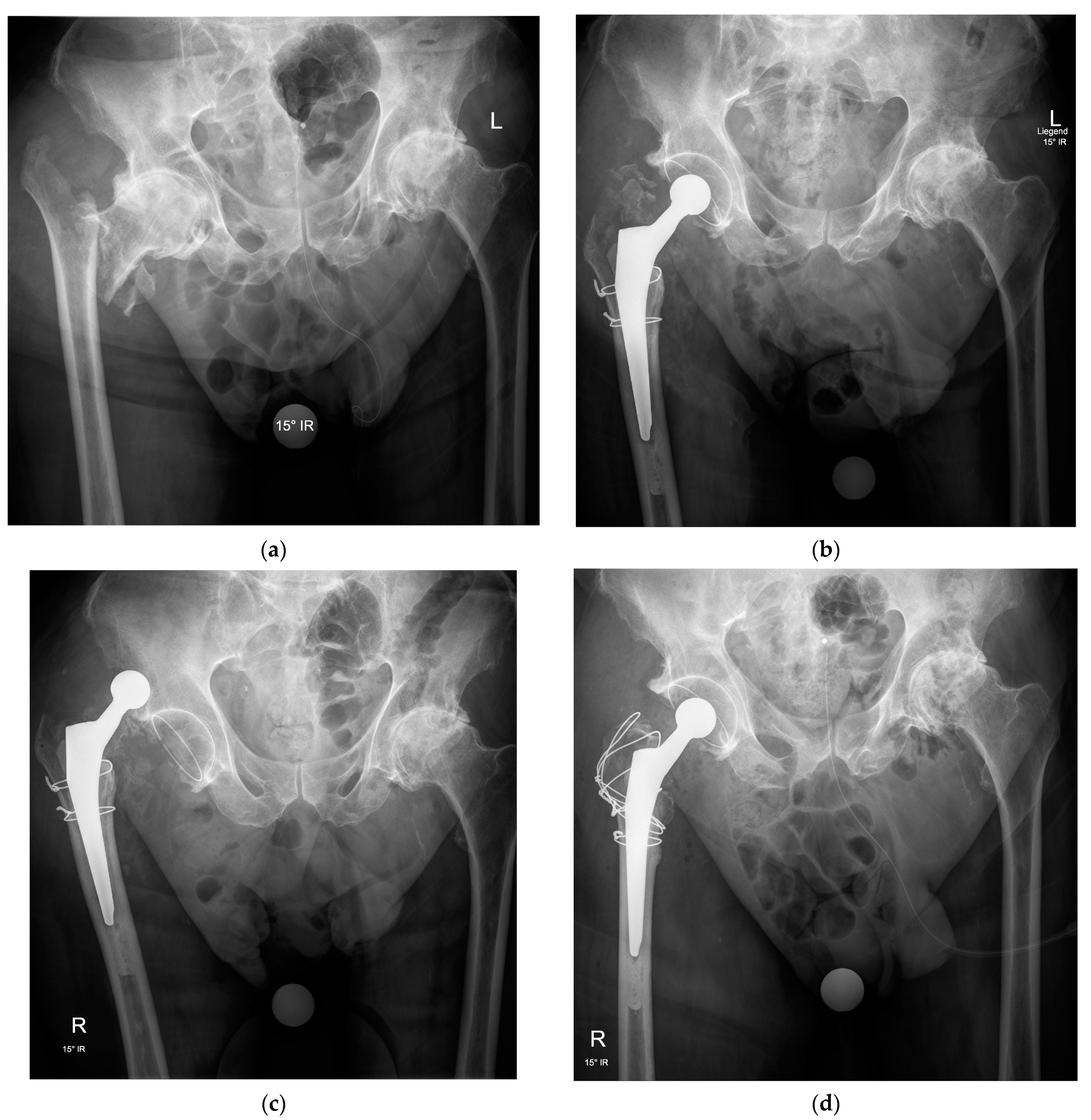 Medicina 57 00763 g003 Medicina 57 00763 g003