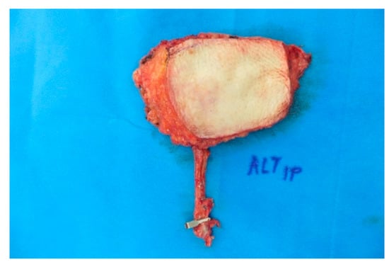 Medicina 57 00795 g0a11 550