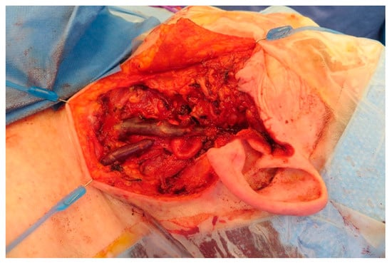 Medicina 57 00795 g0a12 550