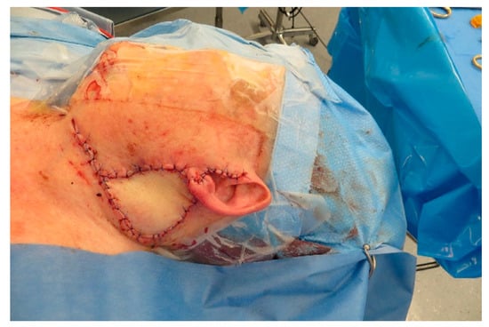 Medicina 57 00795 g0a13 550