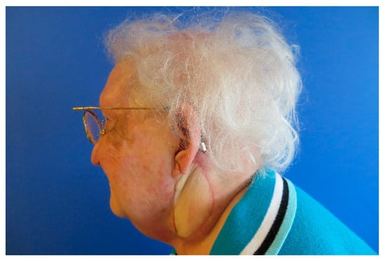 Medicina 57 00795 g0a14 550