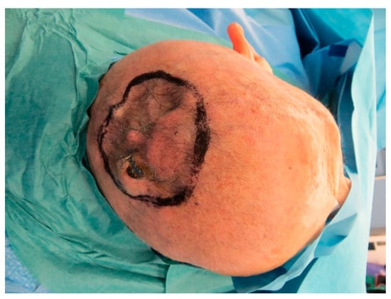 Medicina 57 00795 g0a15 550