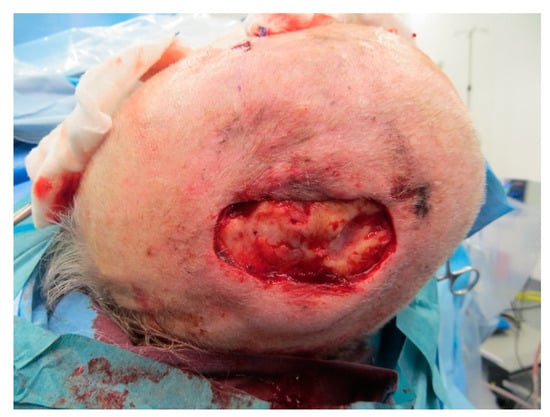 Medicina 57 00795 g0a16 550