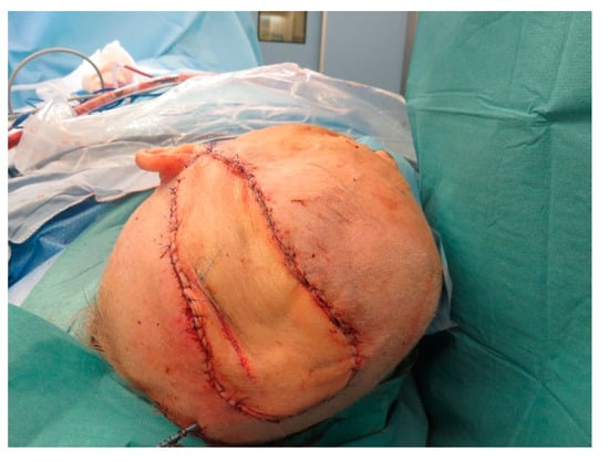 Medicina 57 00795 g0a18 550