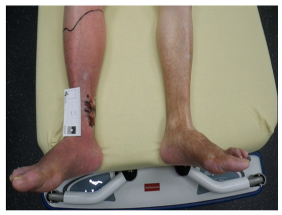 Medicina 57 00795 g0a2 550