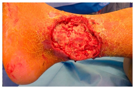 Medicina 57 00795 g0a5 550