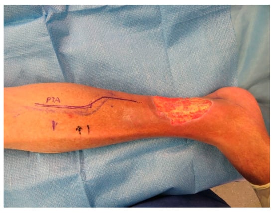 Medicina 57 00795 g0a6 550