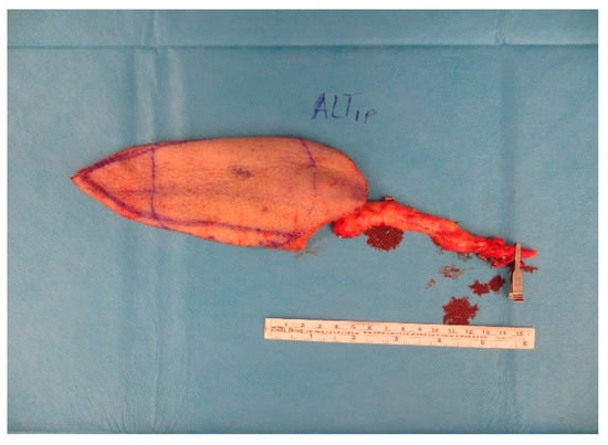 Medicina 57 00795 g0a7 550