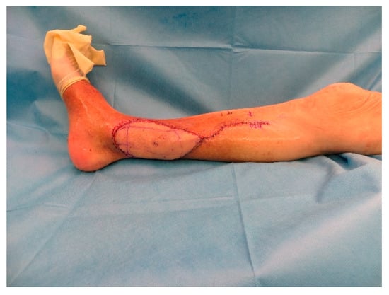 Medicina 57 00795 g0a8 550