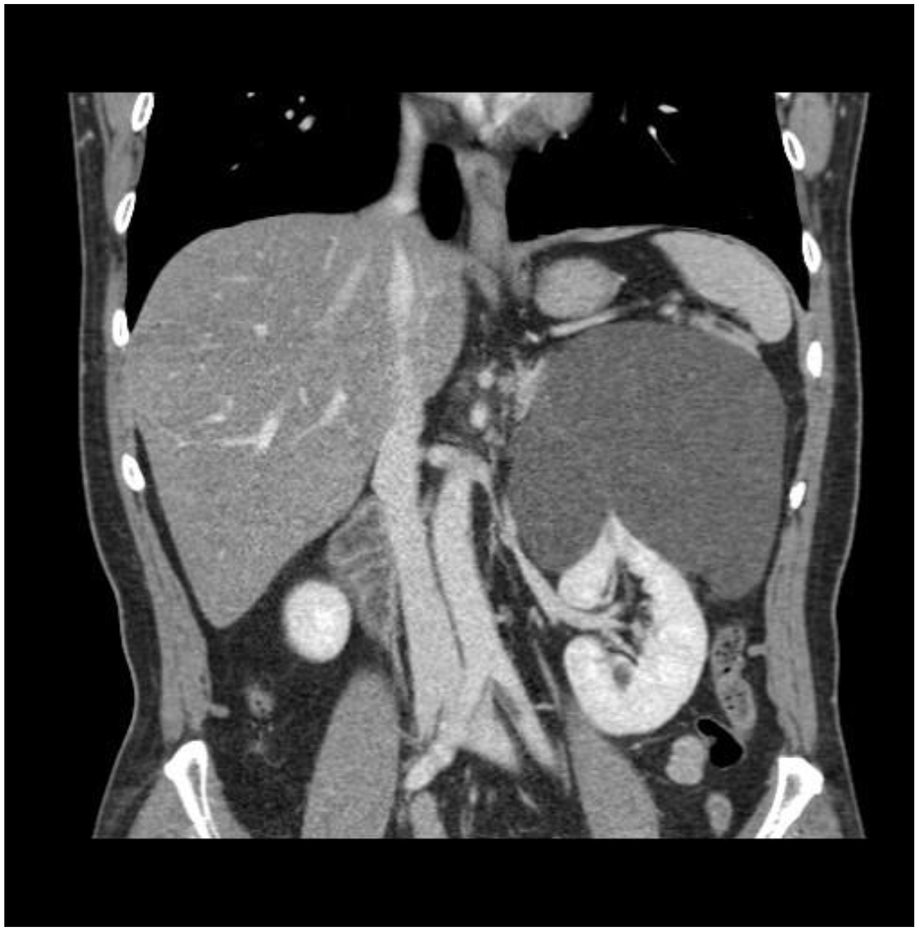 Medicina 57 00851 g001