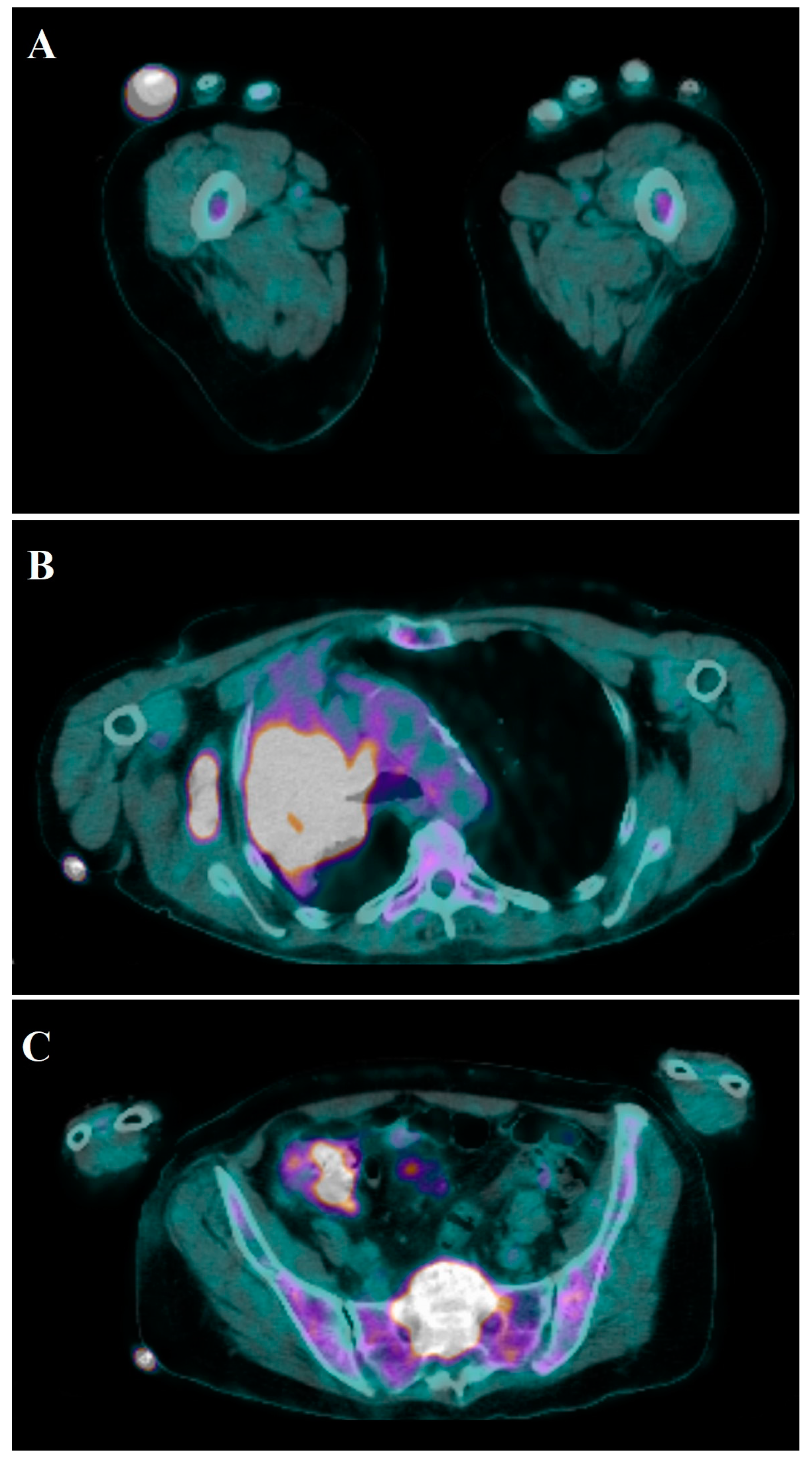 Medicina 57 00950 g004