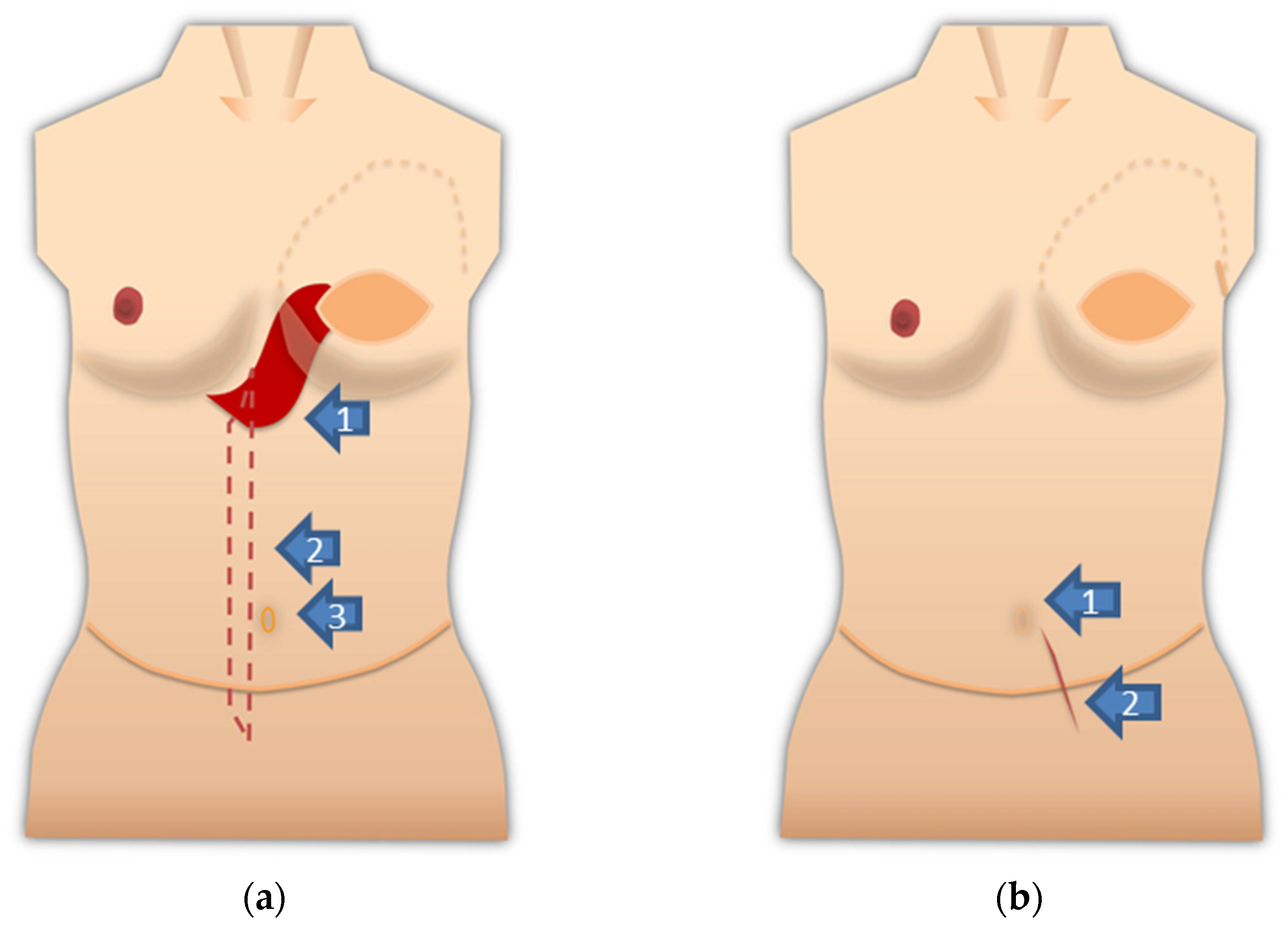 Medicina 57 00952 g002