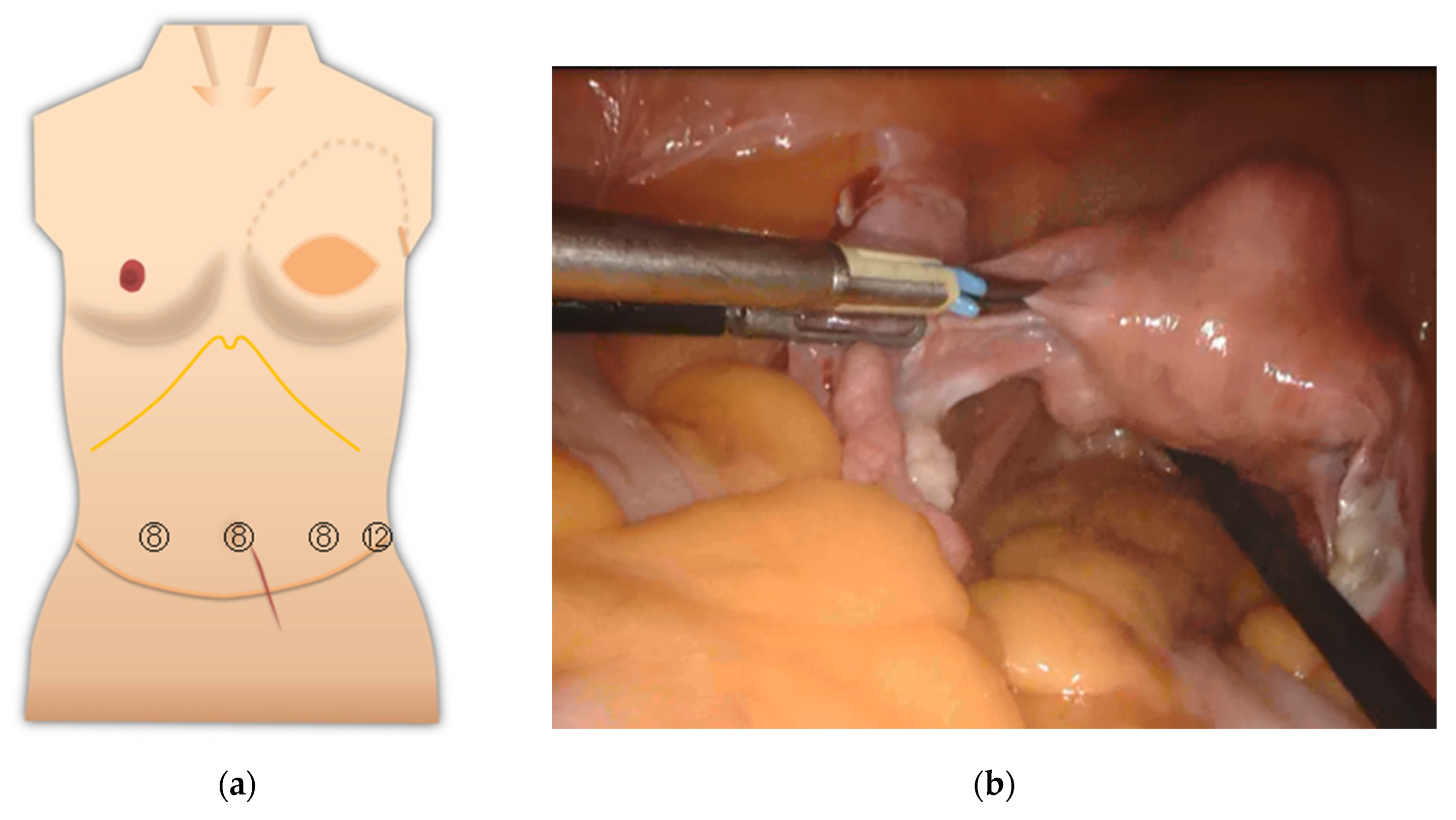 Medicina 57 00952 g003