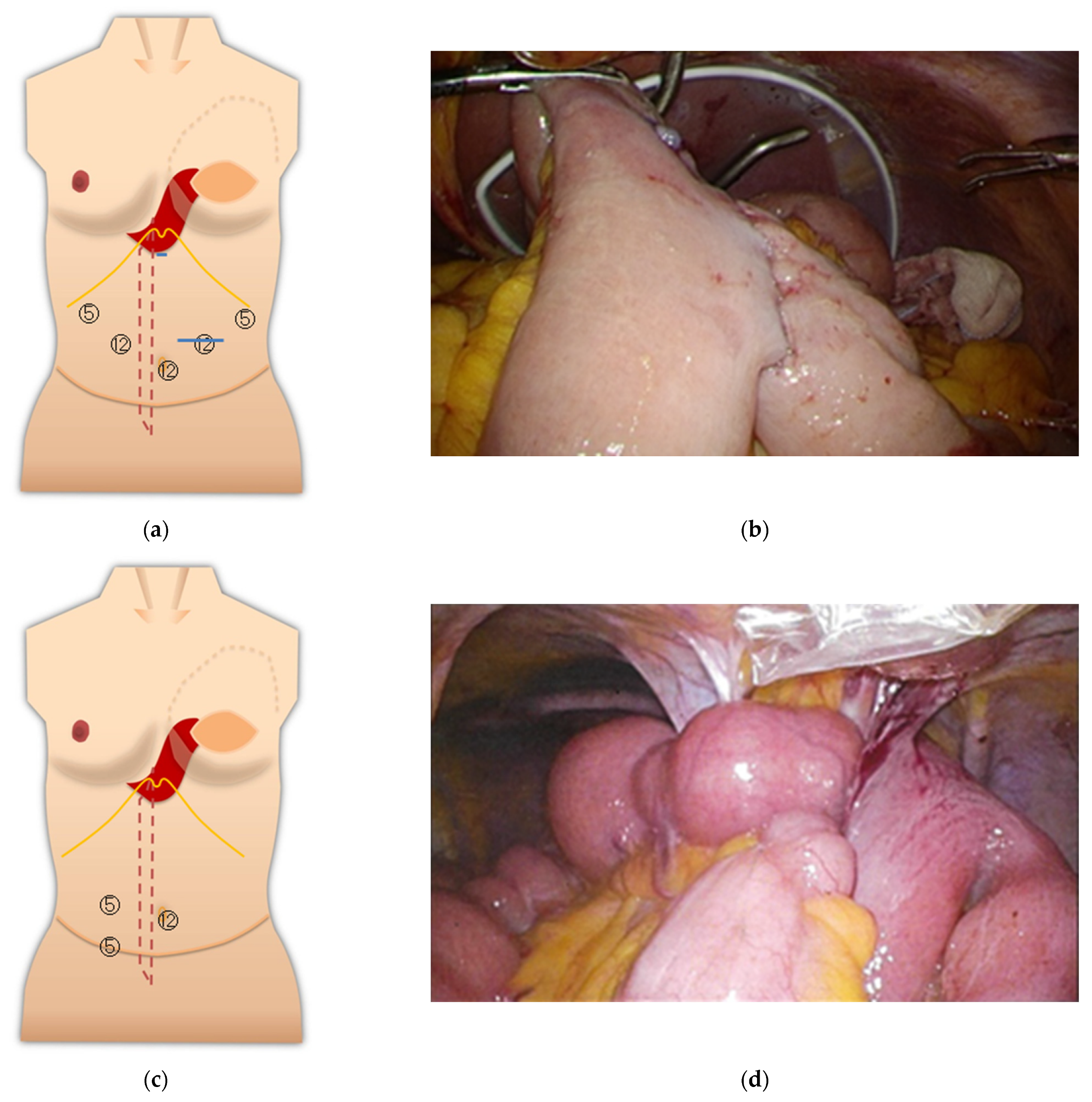 Medicina 57 00952 g004