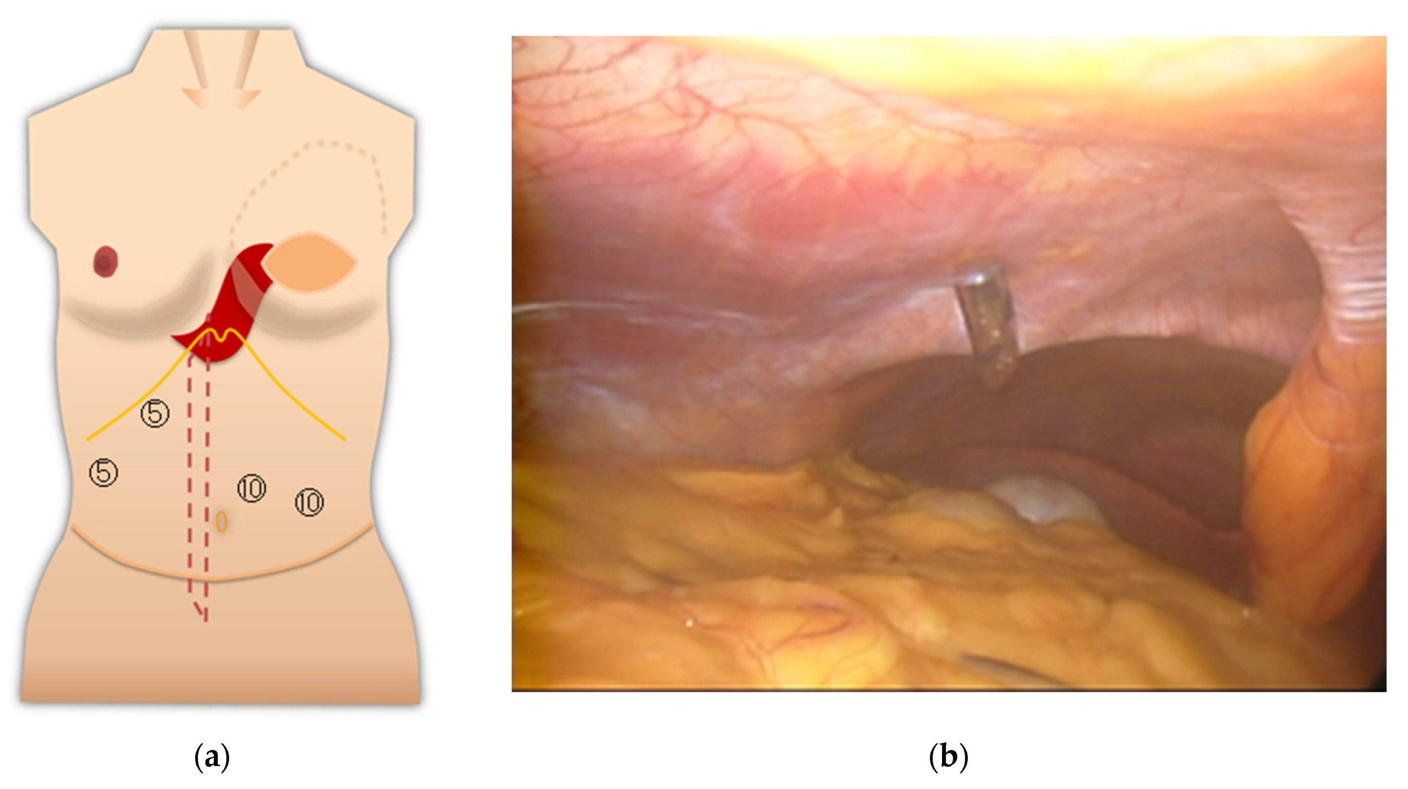 Medicina 57 00952 g005
