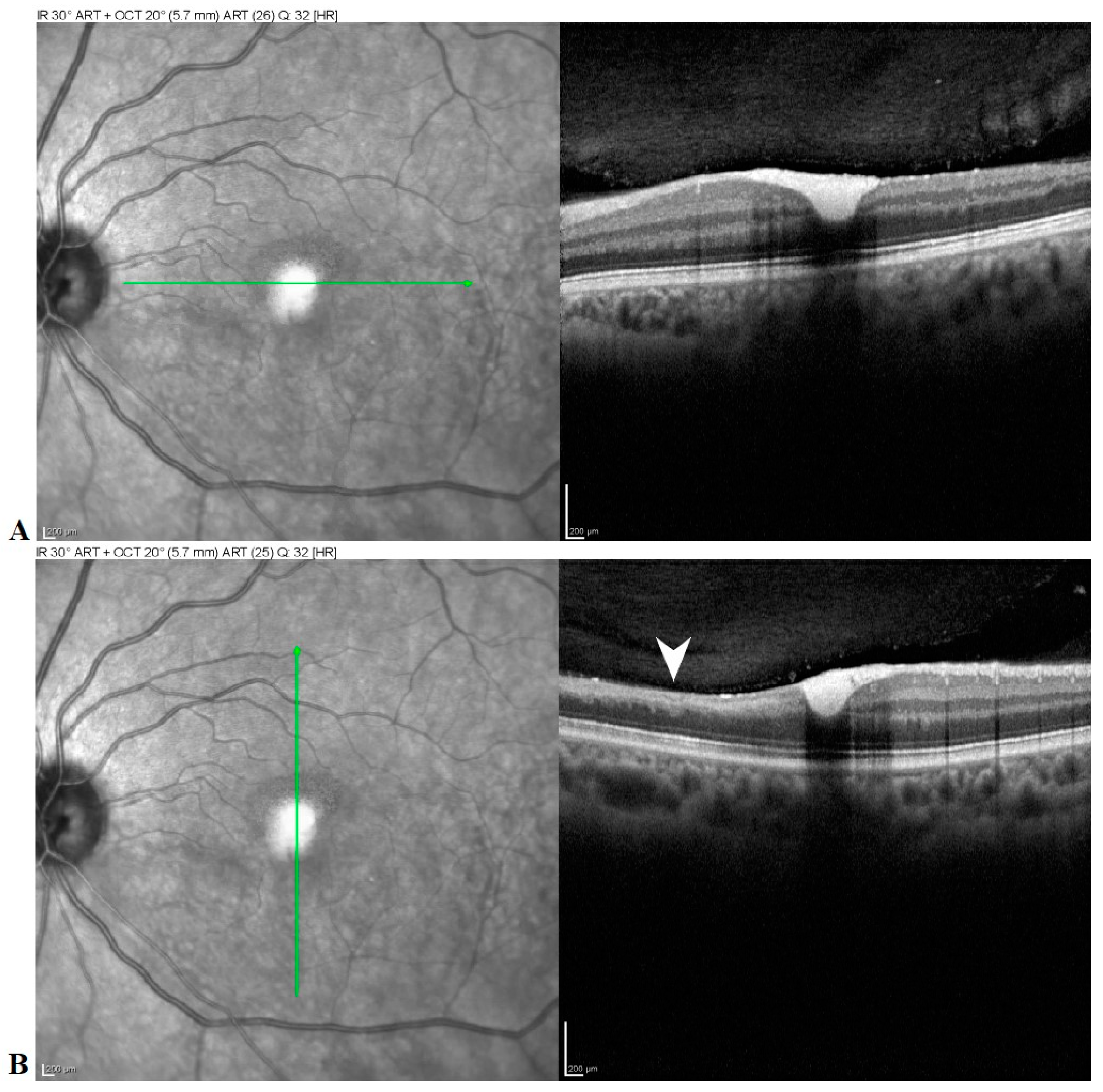 Medicina 57 00963 g005