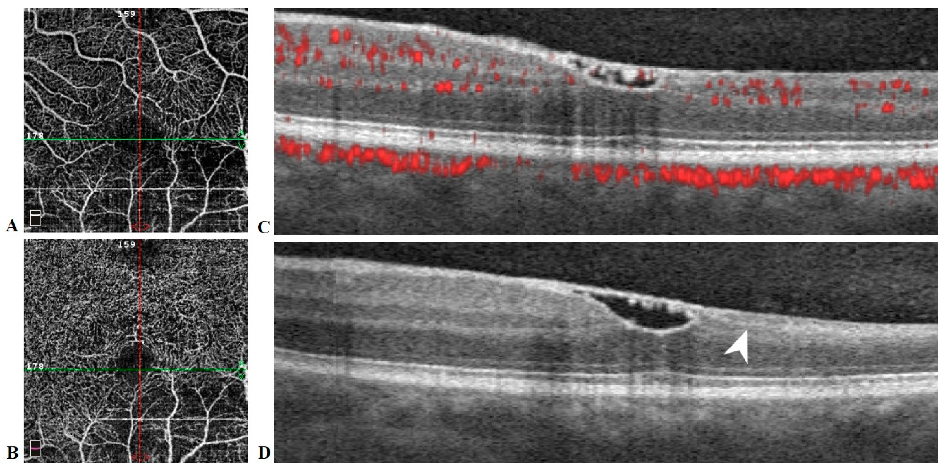Medicina 57 00963 g006