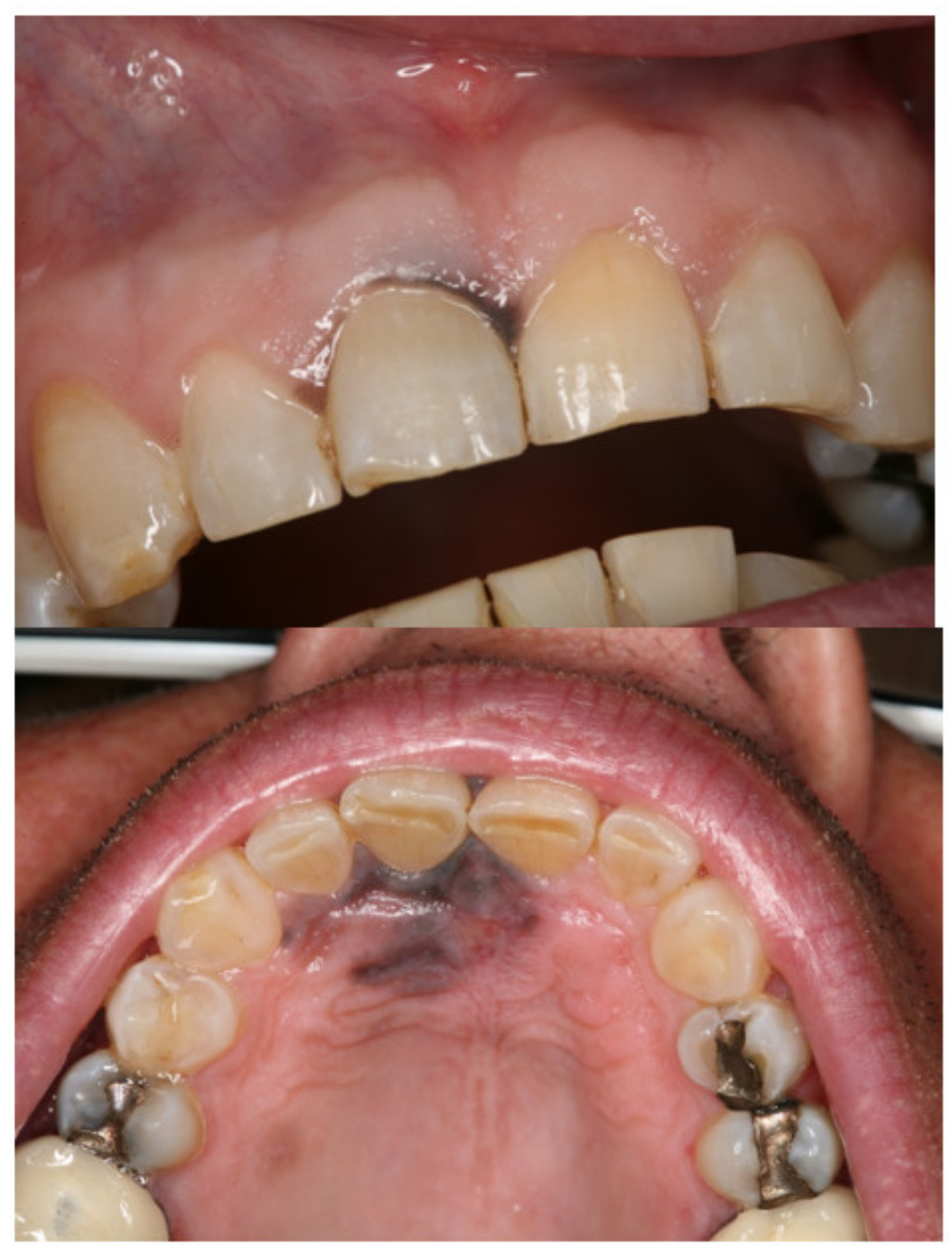 Medicina 57 00965 g001