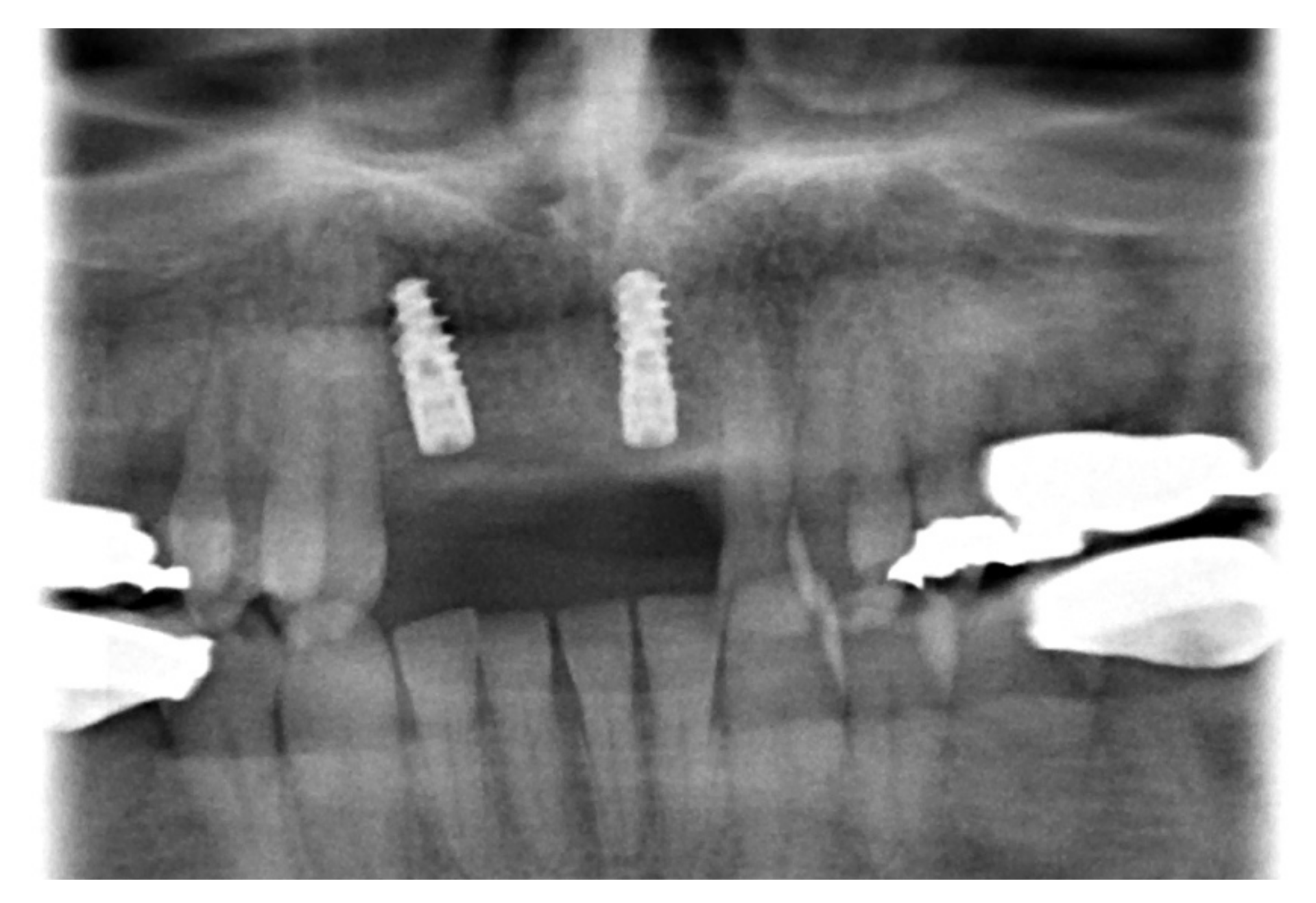 Medicina 57 00965 g005