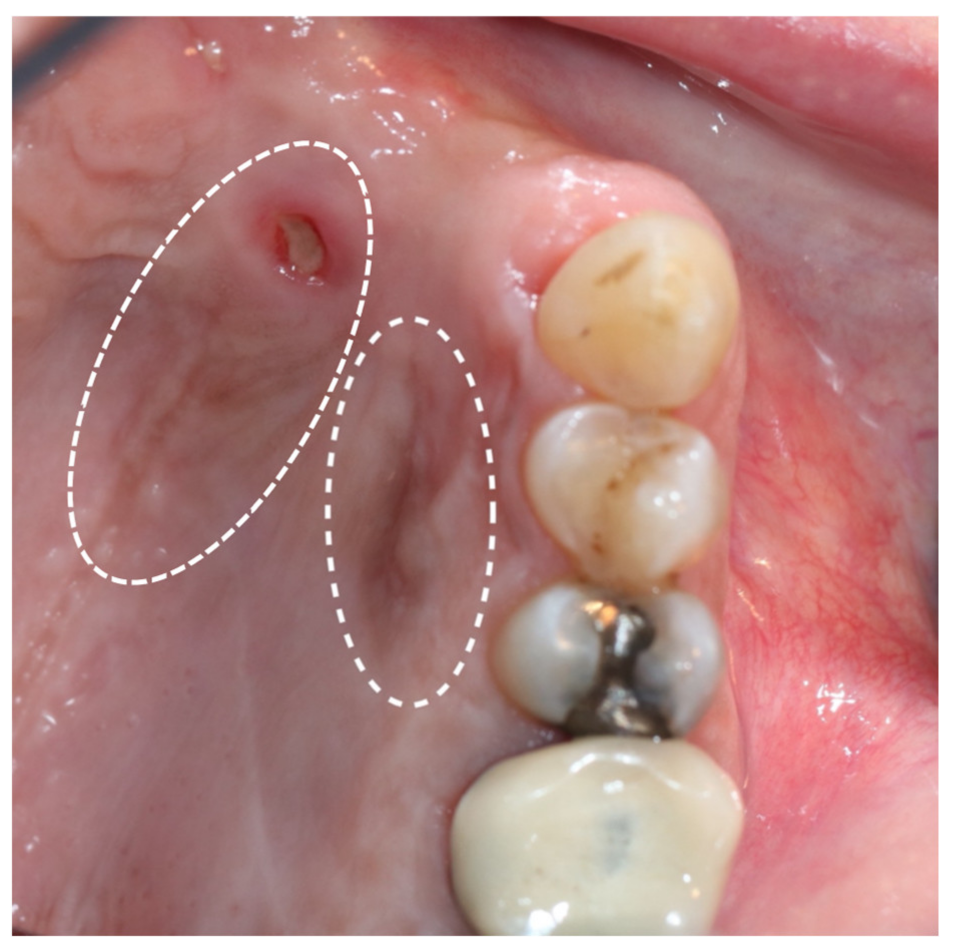 Medicina 57 00965 g006