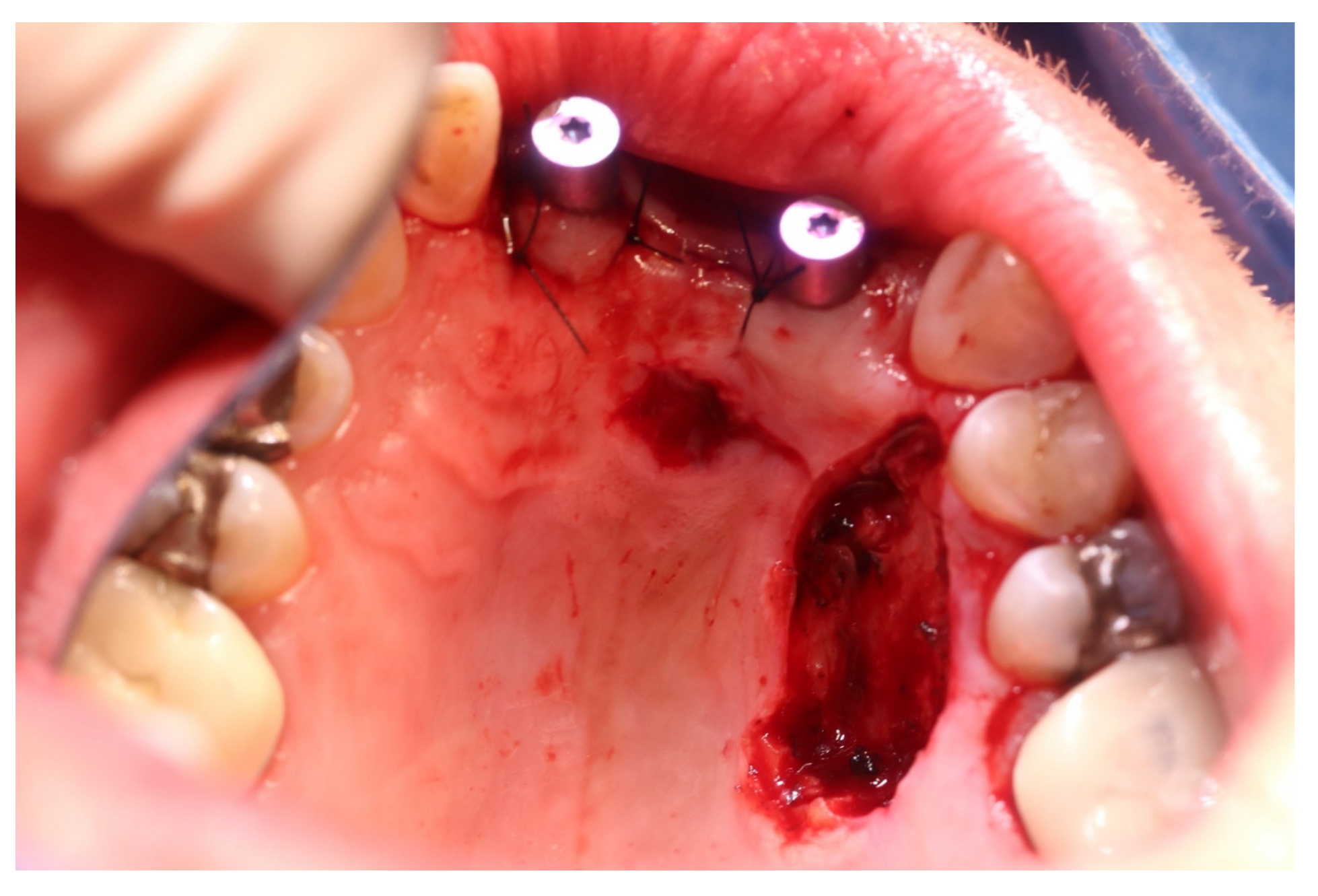 Medicina 57 00965 g007