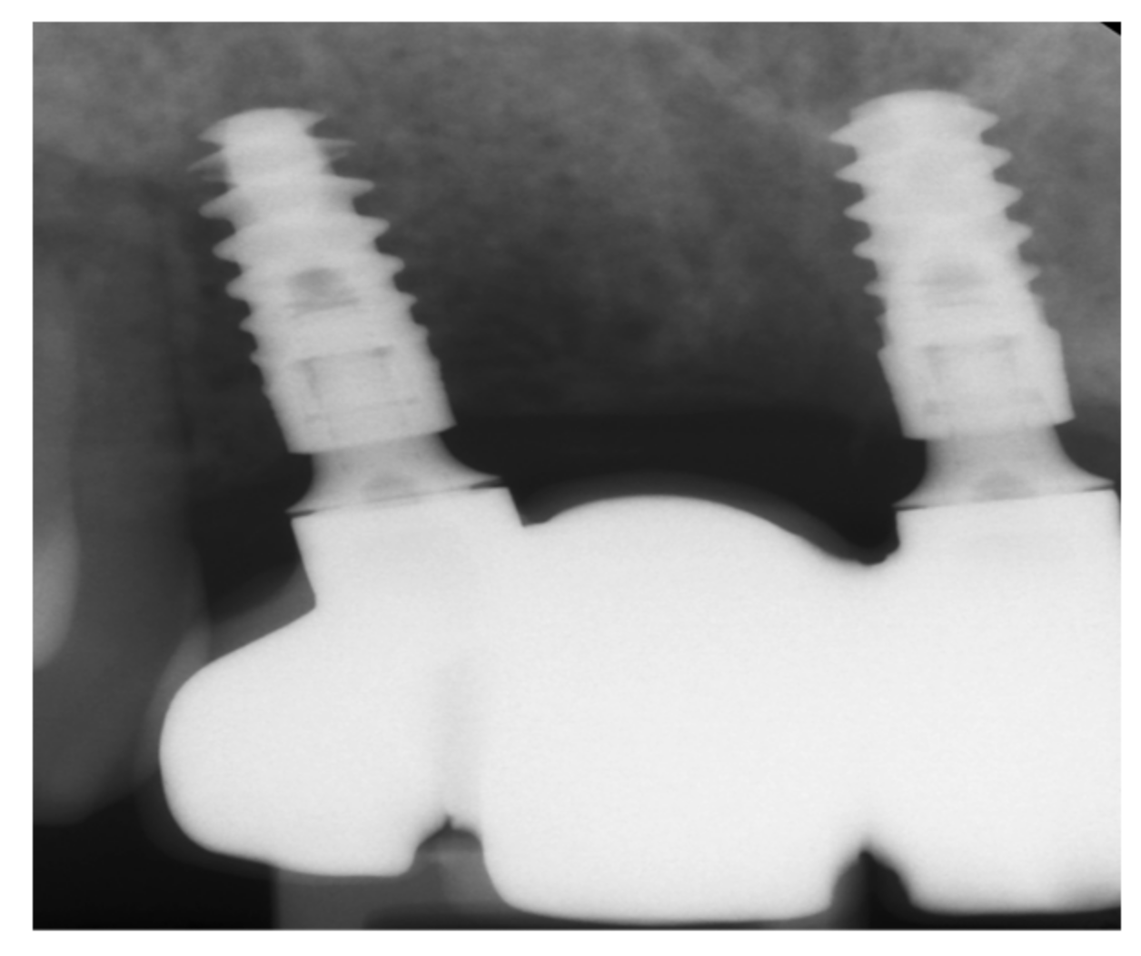 Medicina 57 00965 g008