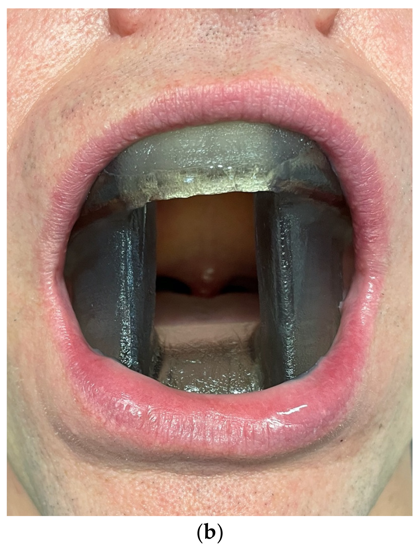 Medicina 57 00965 g009b