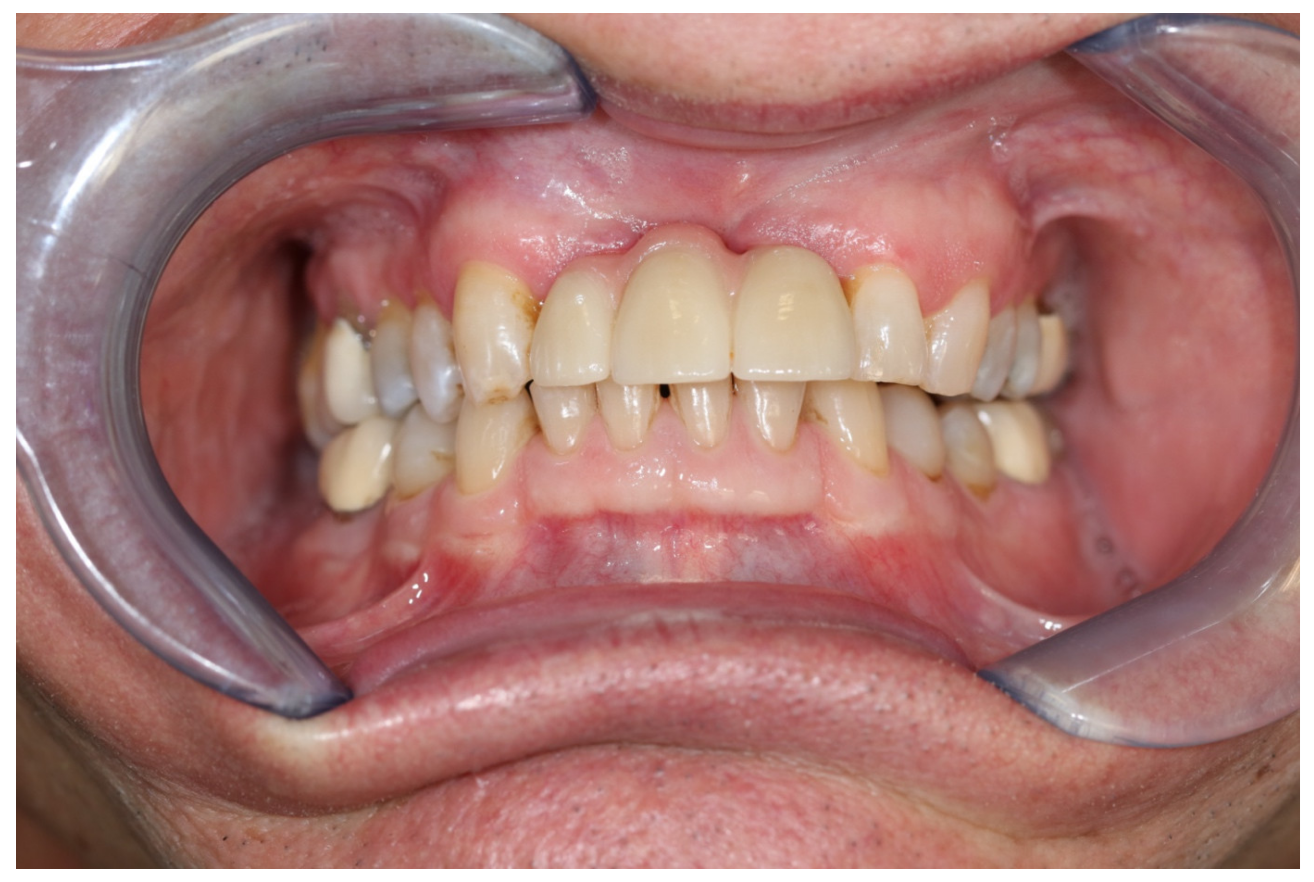 Medicina 57 00965 g010