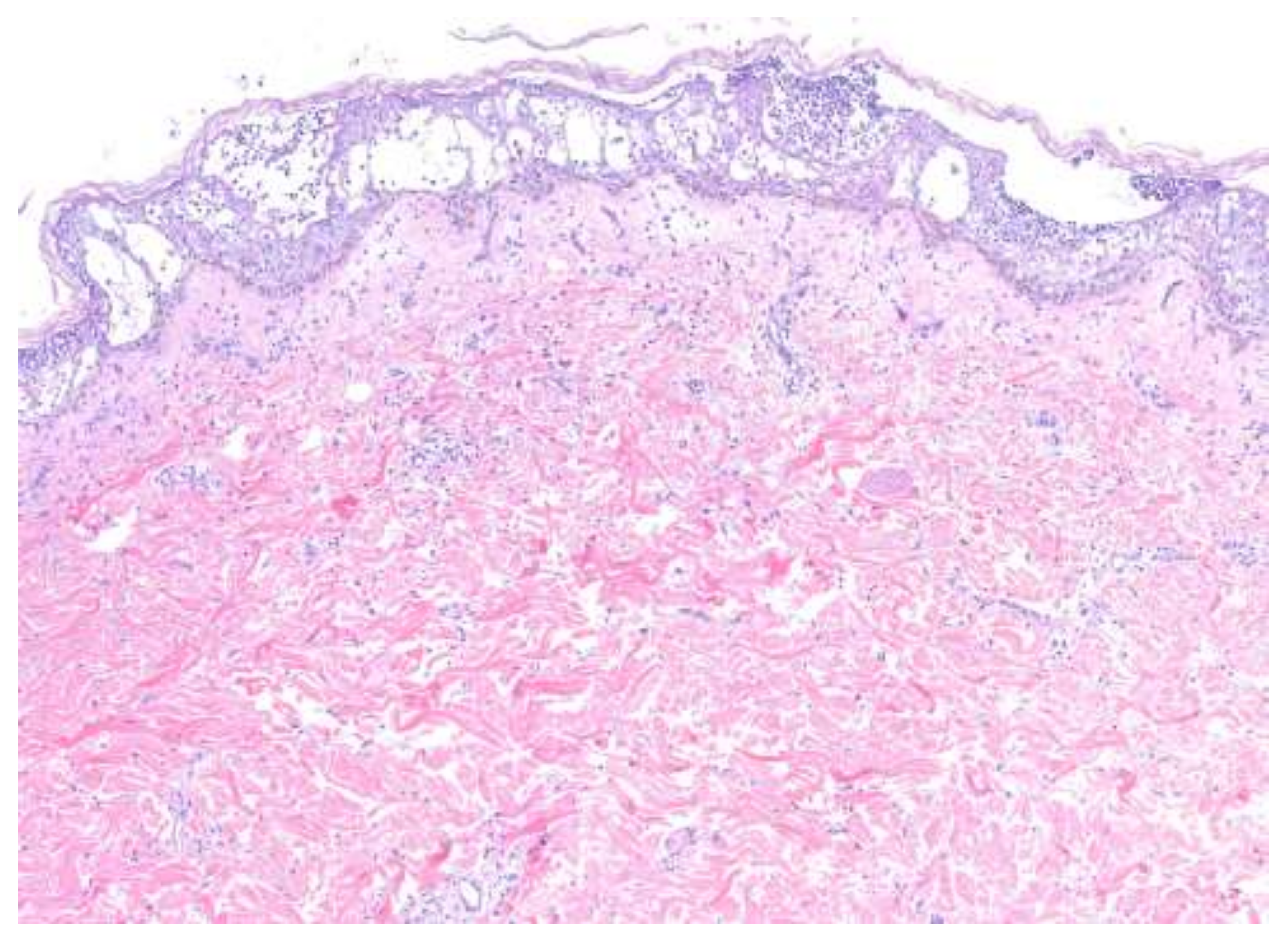 Medicina 57 01004 g004