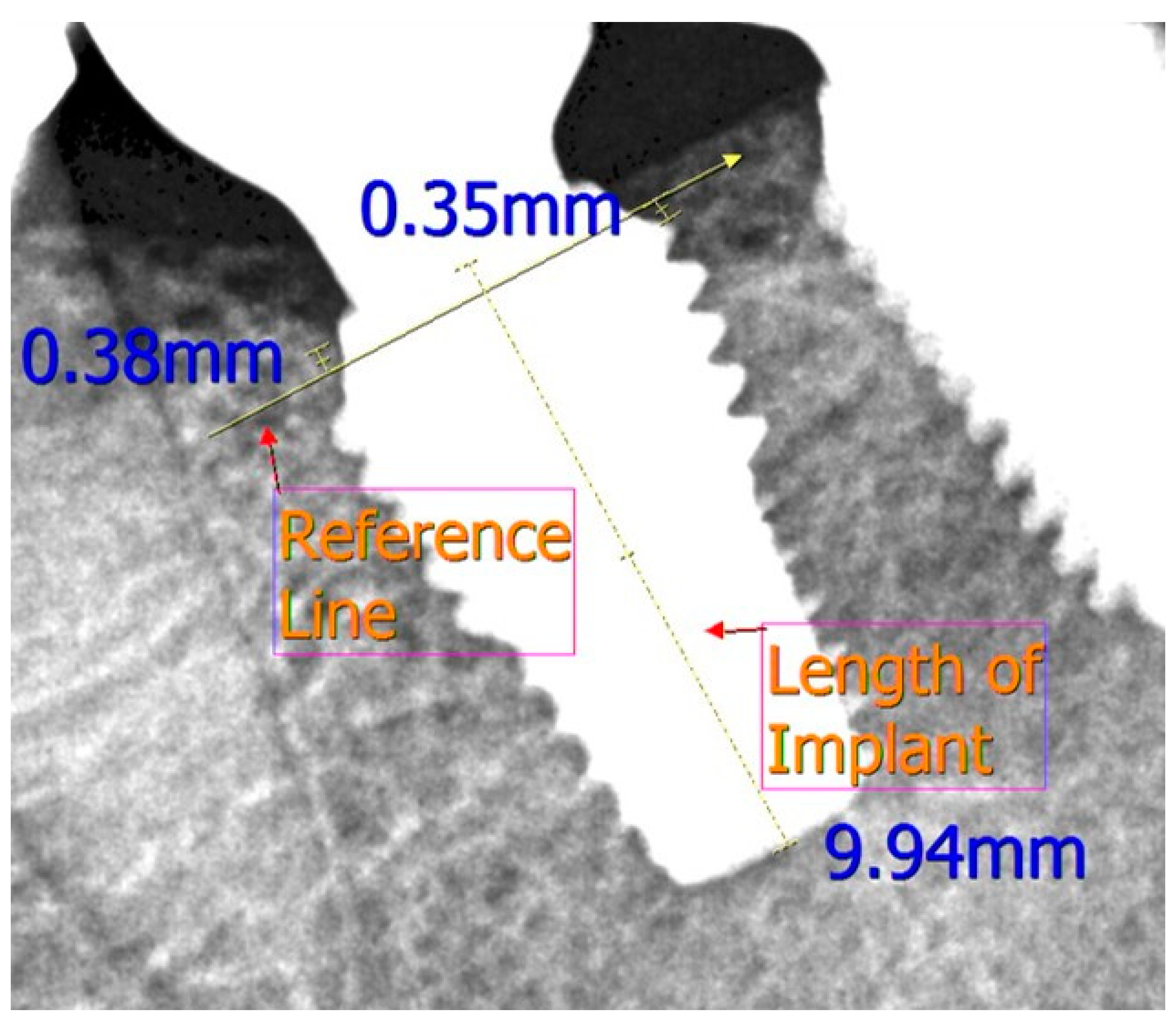 Medicina 57 01009 g002