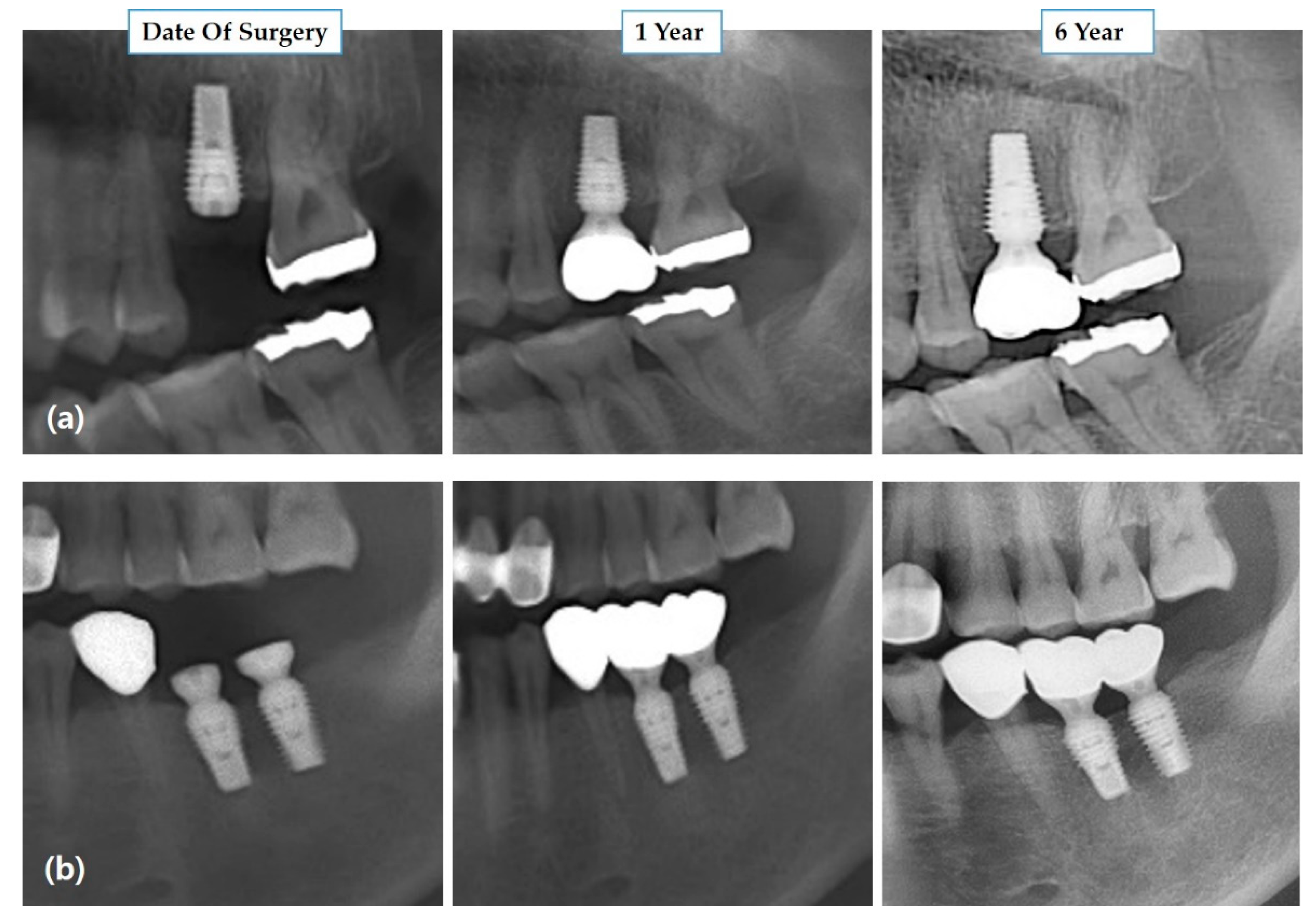 Medicina 57 01009 g003